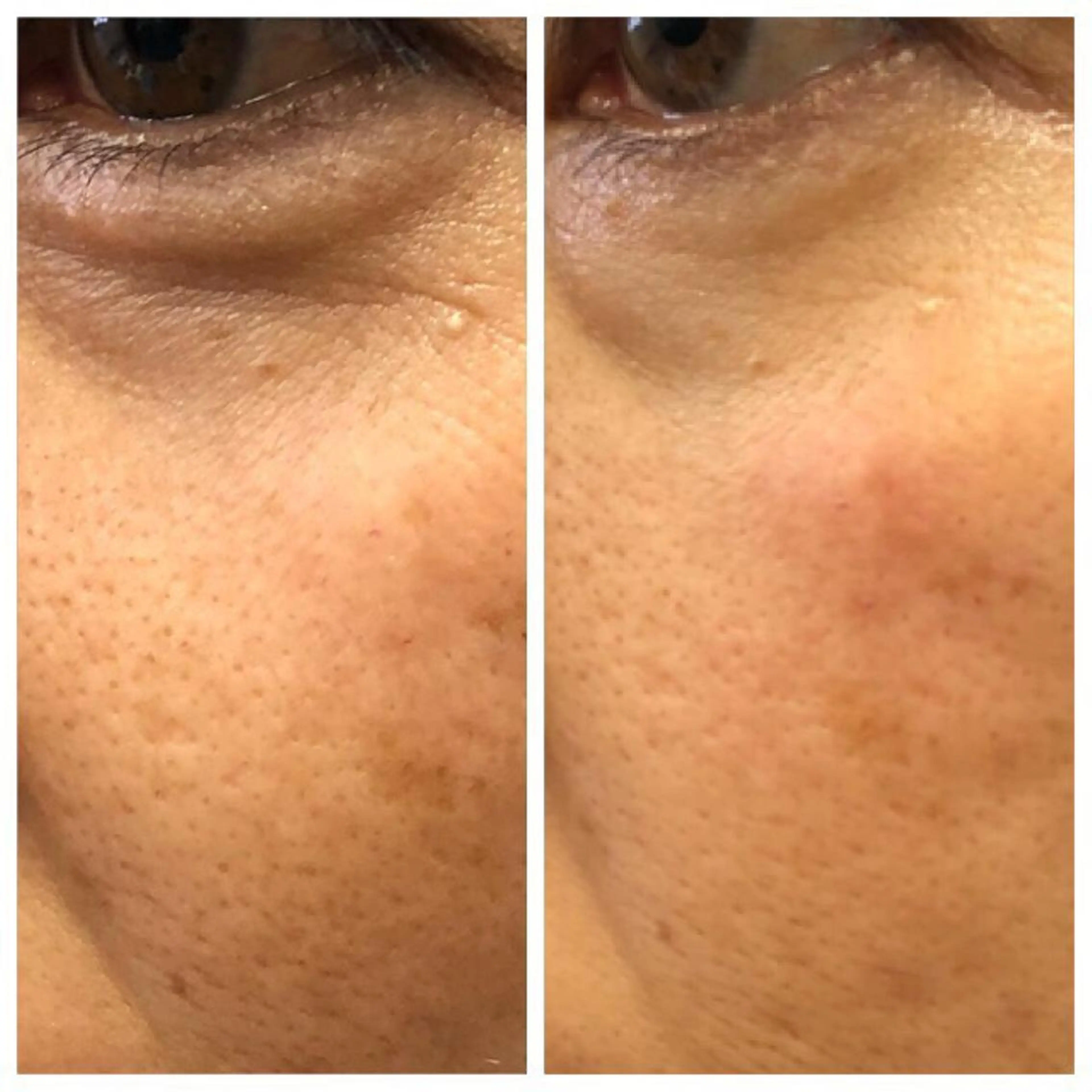 ESPOIR エスポワールのエステ・リラクイメージ