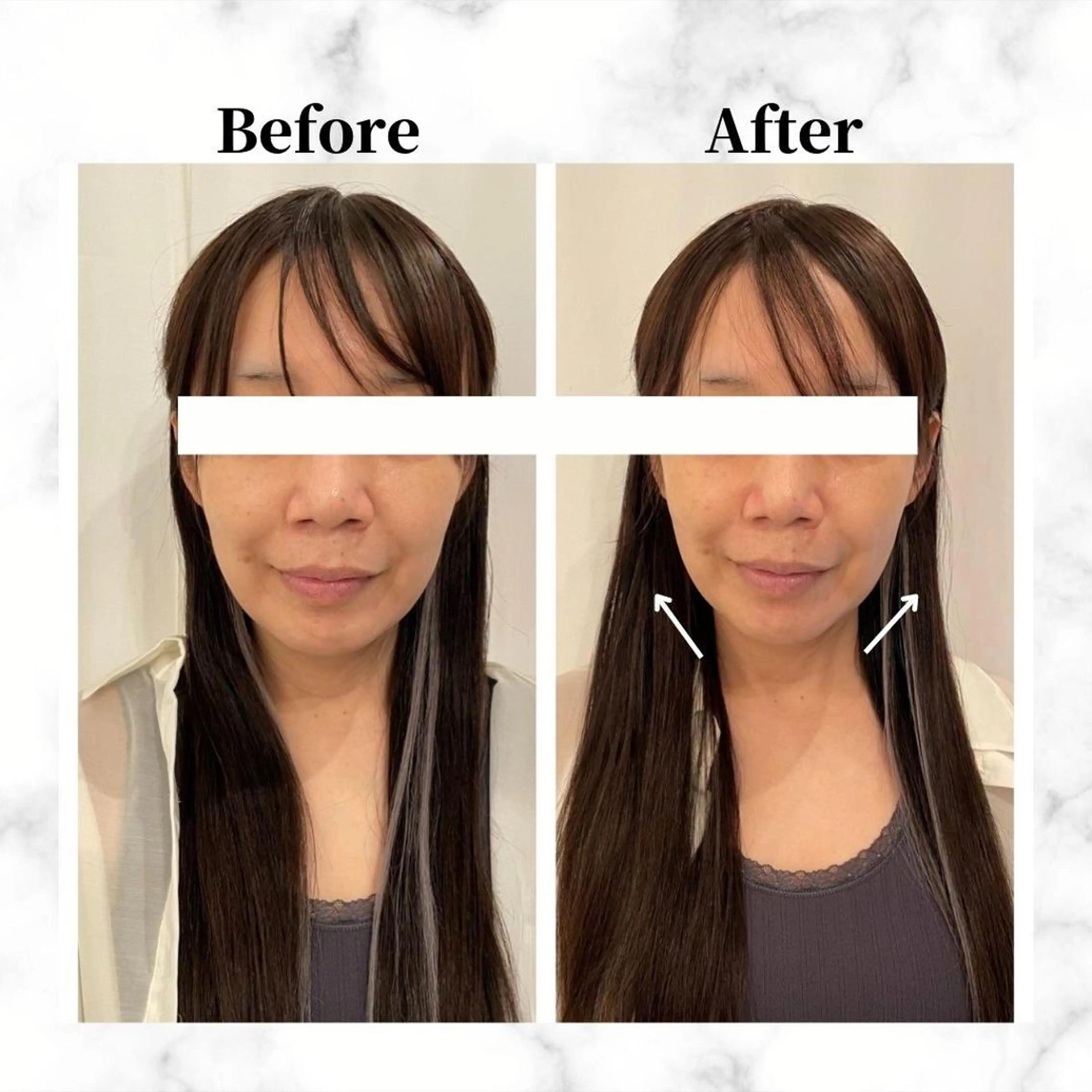 12Dハイフ💗 最強小顔のエステ・リラクイメージ