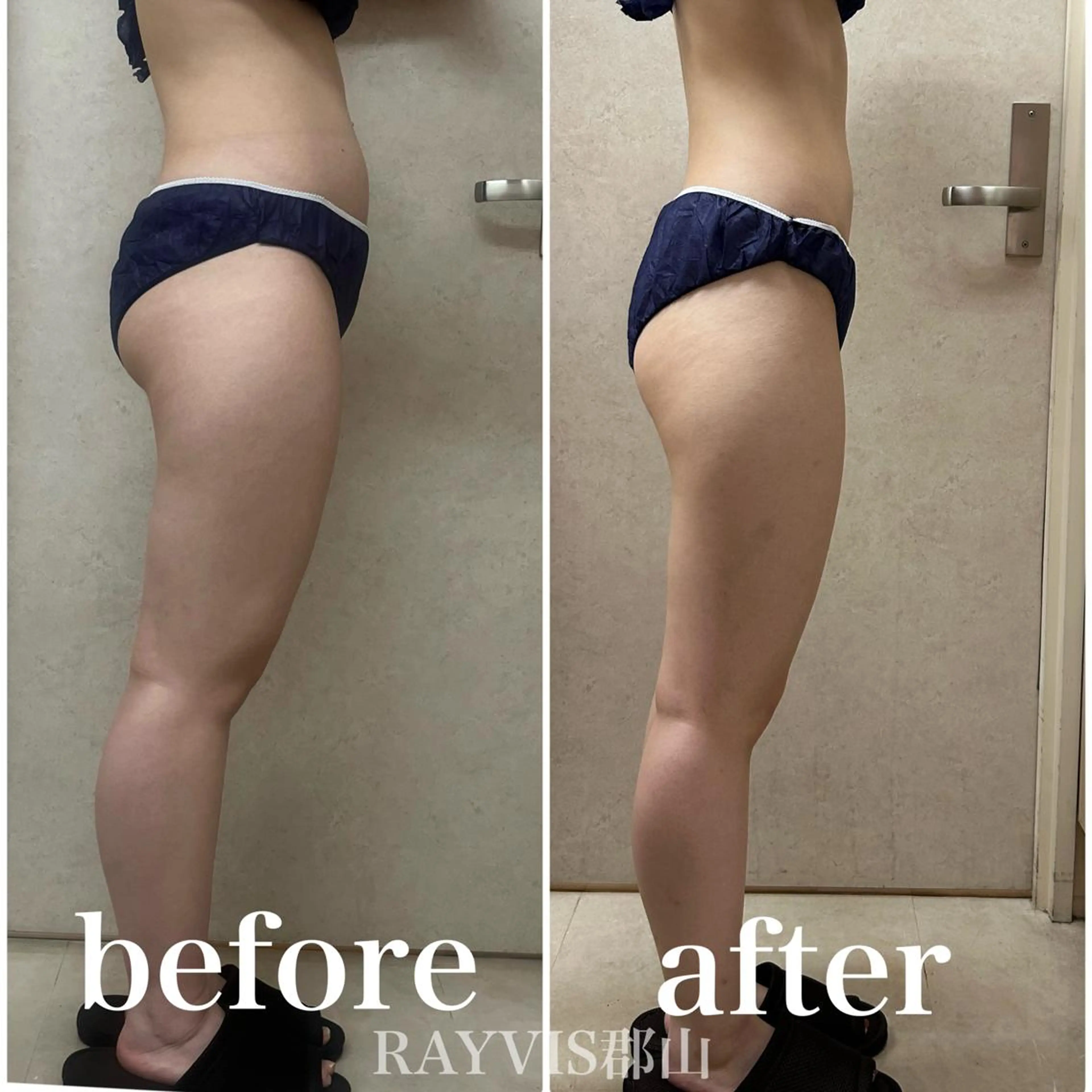 🌹毛穴小顔エステ レイビス郡山店🌹のエステ・リラクイメージ