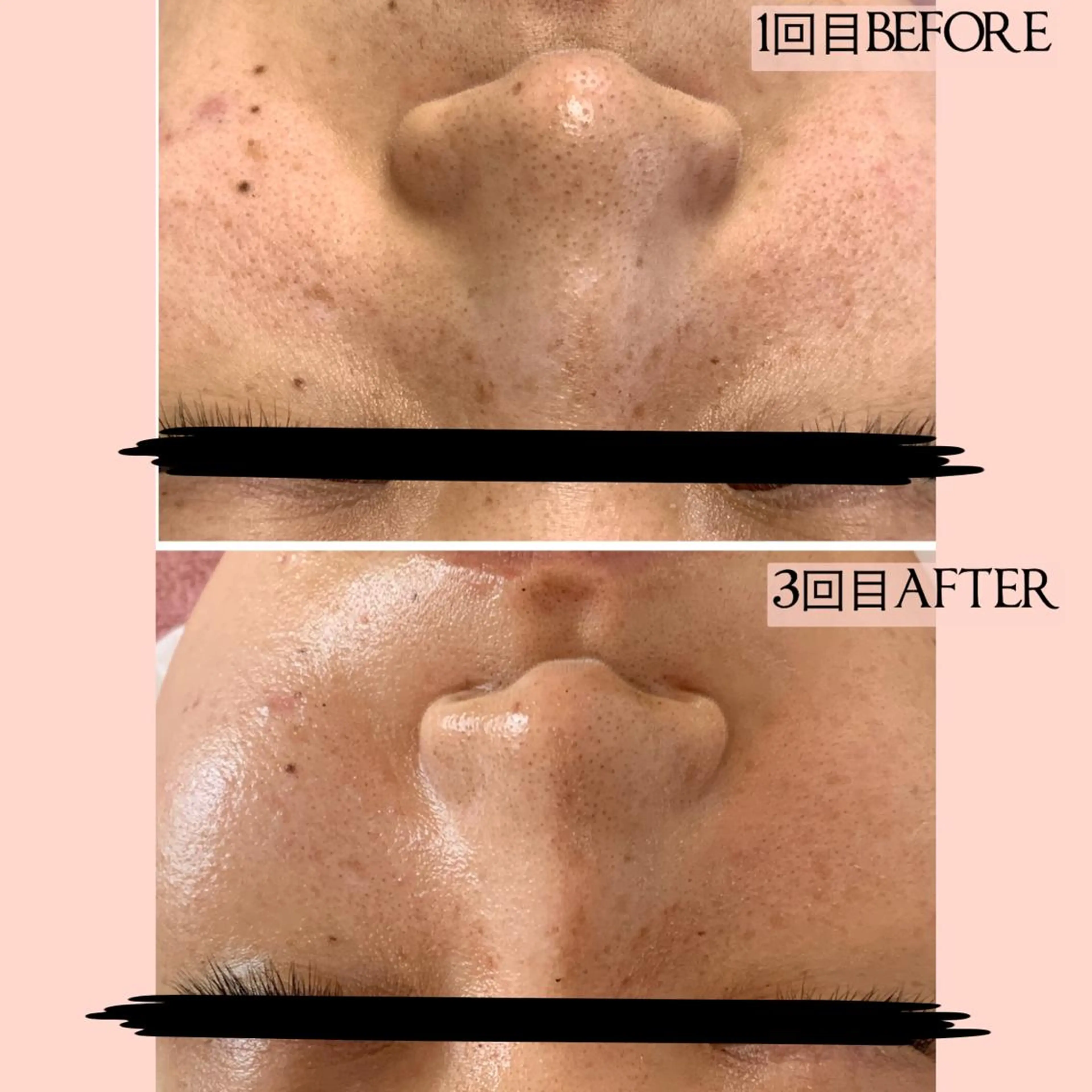 堀井 舞琳のエステ・リラクイメージ