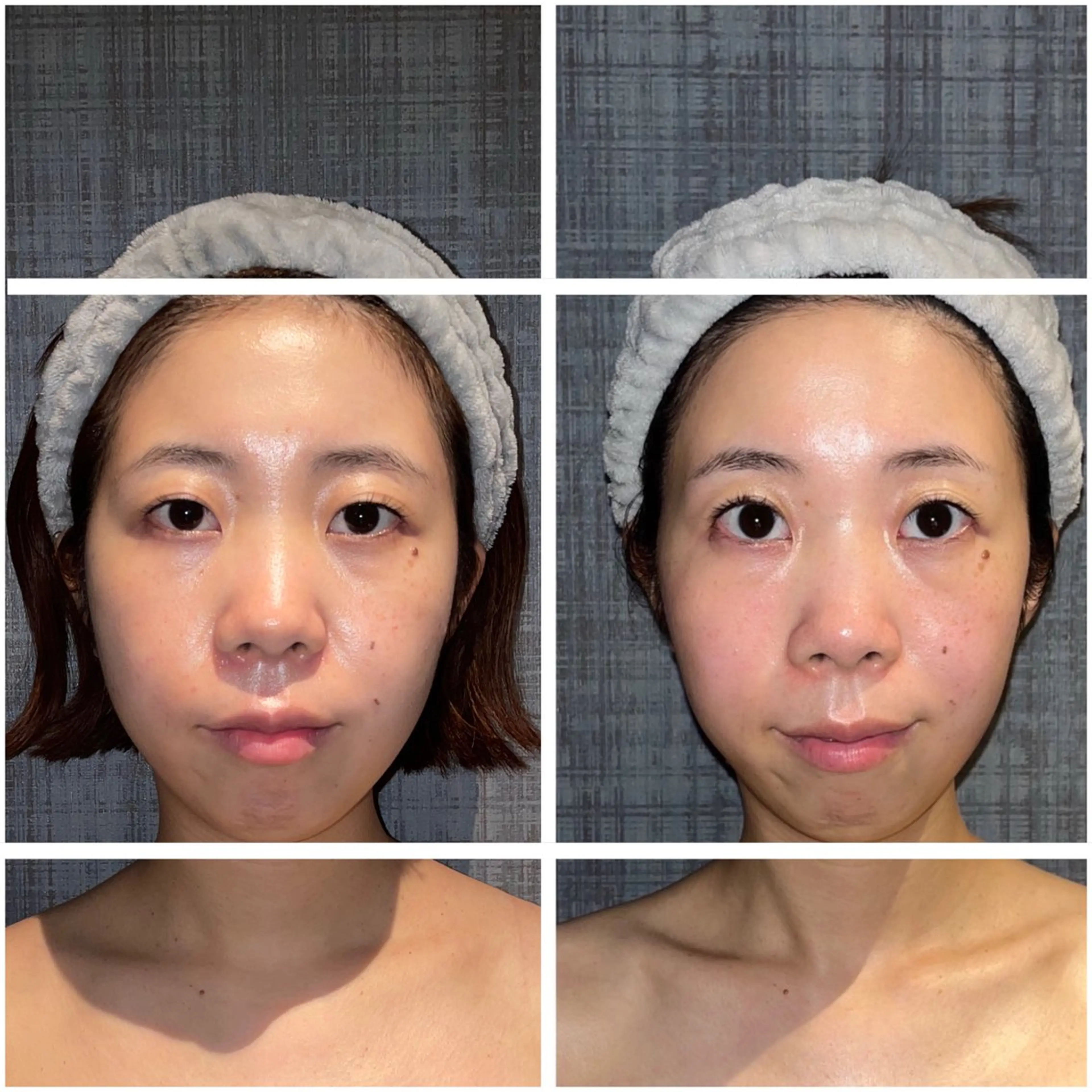 【平日×3名限定】5回で実感!結果にこだわる《こりとりコルギ》🦴💆♀️✨90分施術の写真