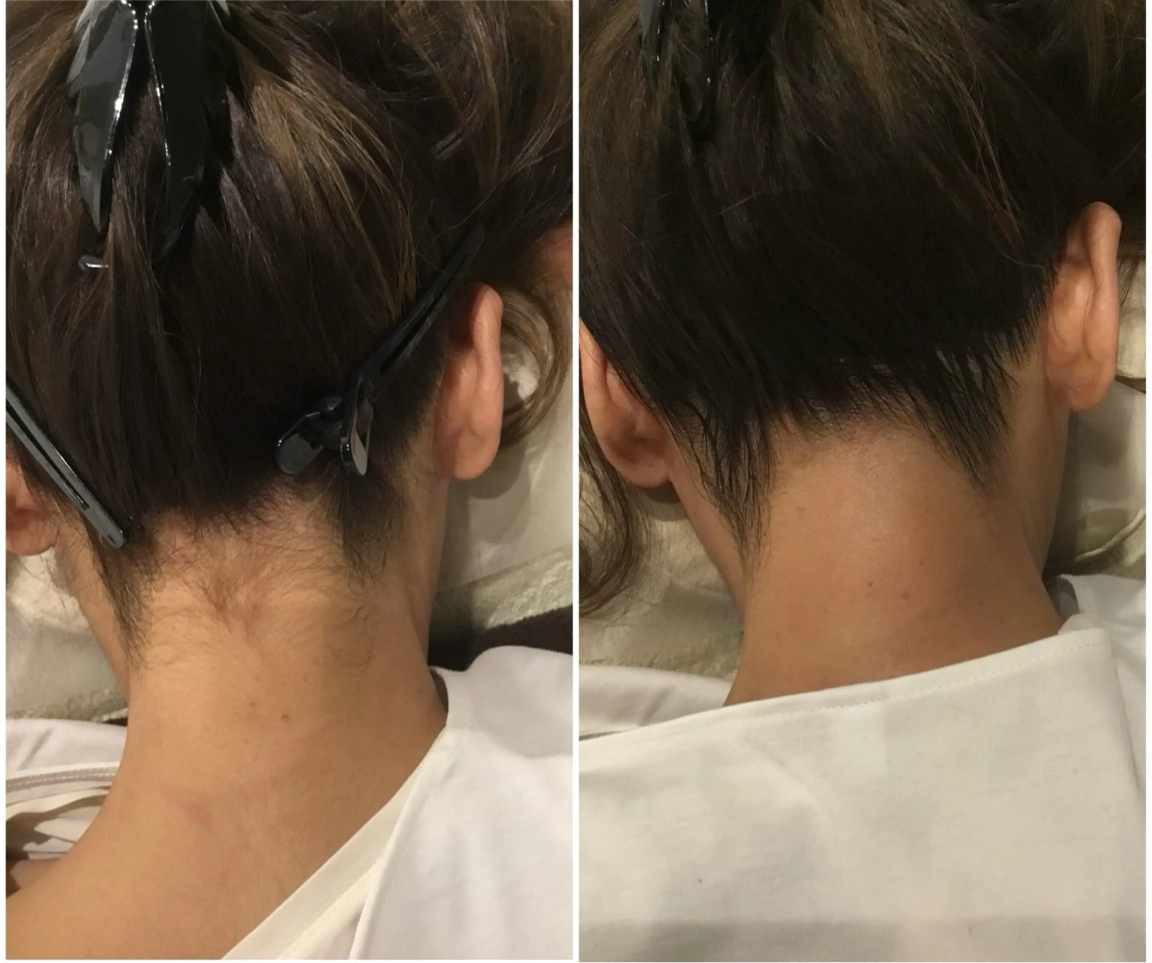 メディカルビューティーSalon Links所属・稲木 俊子のエステ・リラクイメージ