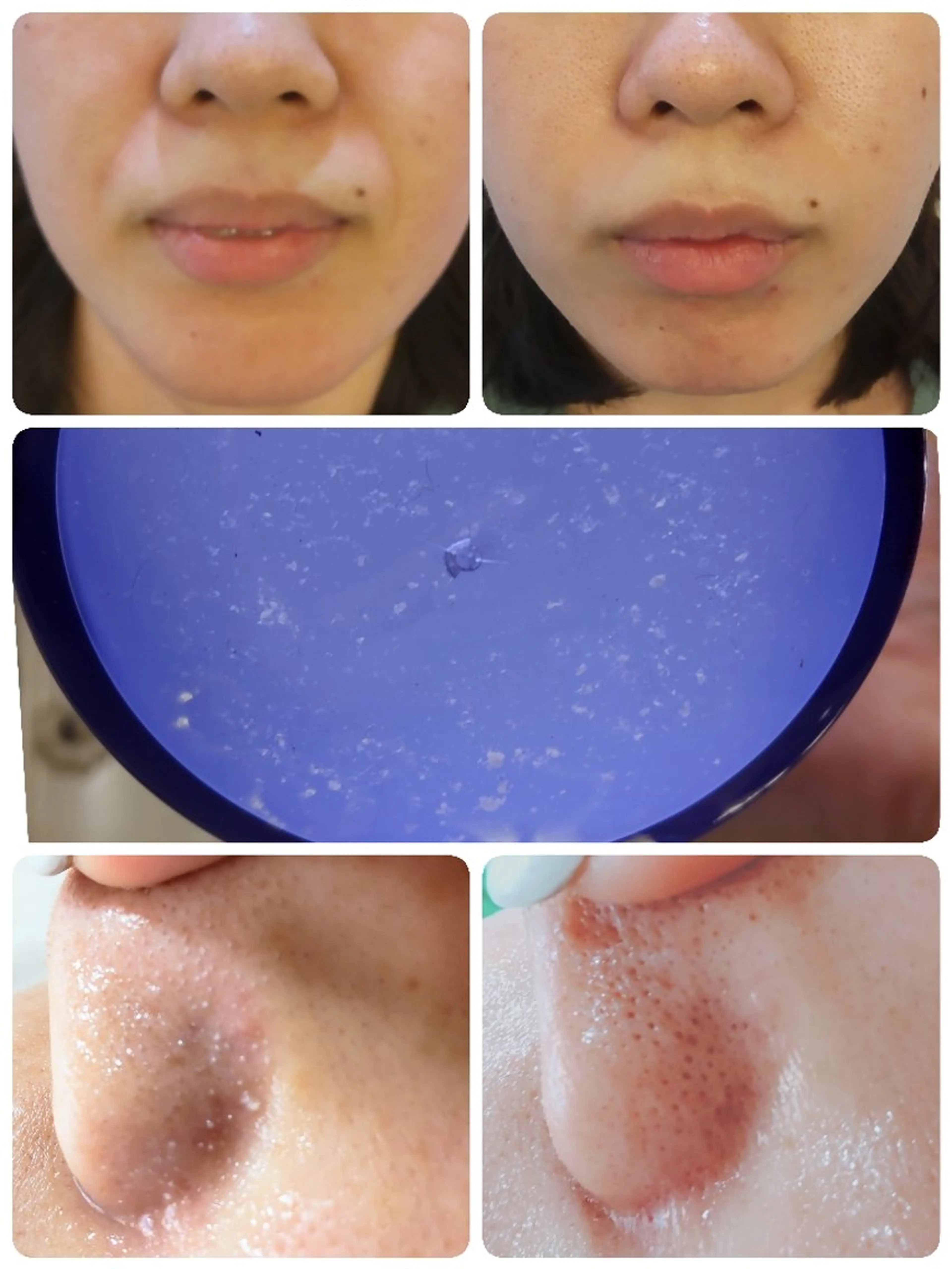 角質・毛穴洗浄🌼 脱毛🌸嶋津弘美のエステ・リラクイメージ