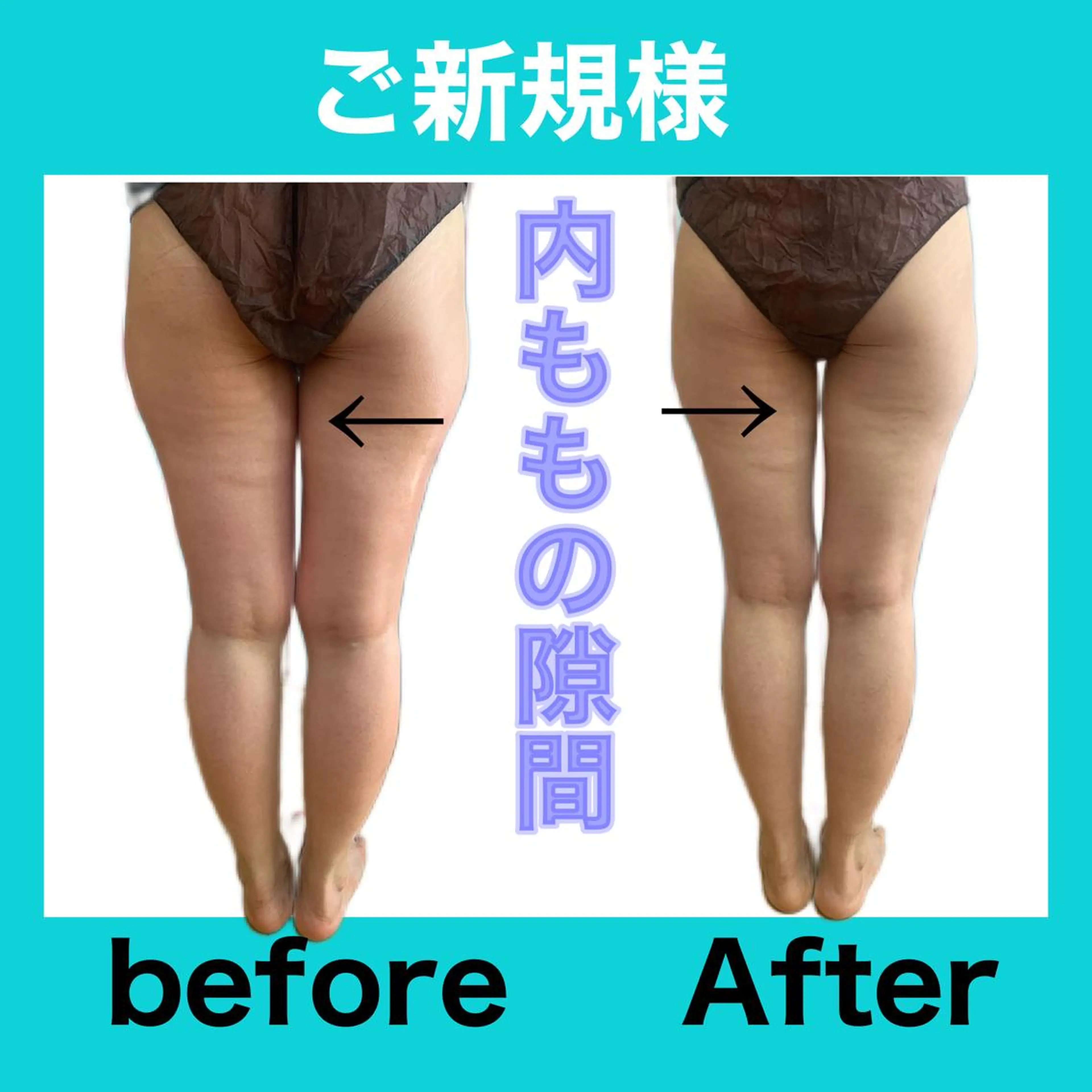 エステ リラク 痩身/脱毛/ネイル HARUKAのエステ・リラクイメージ