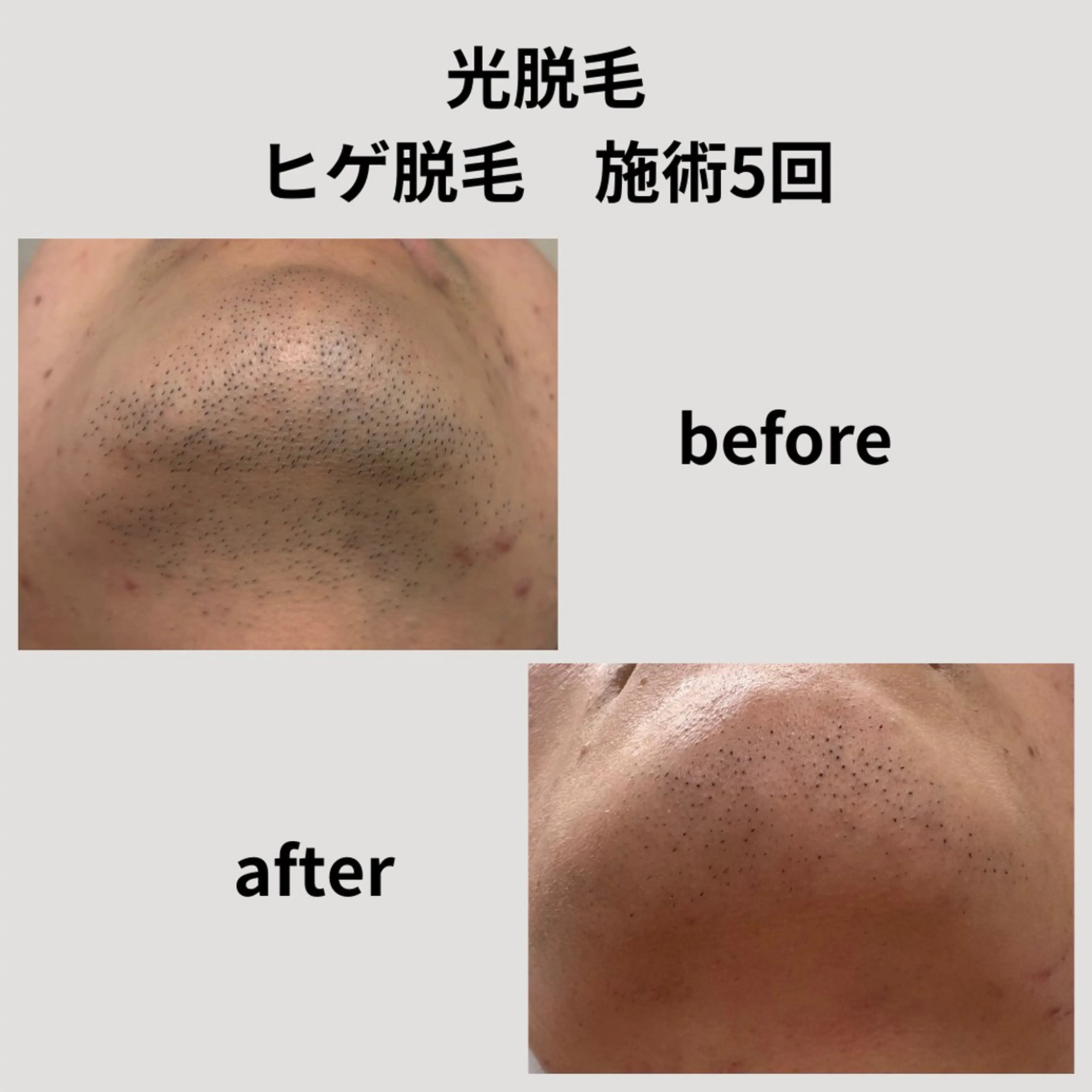 メンズ 脱毛 脱毛＆フェイシャル H'euriaのエステ・リラクイメージ