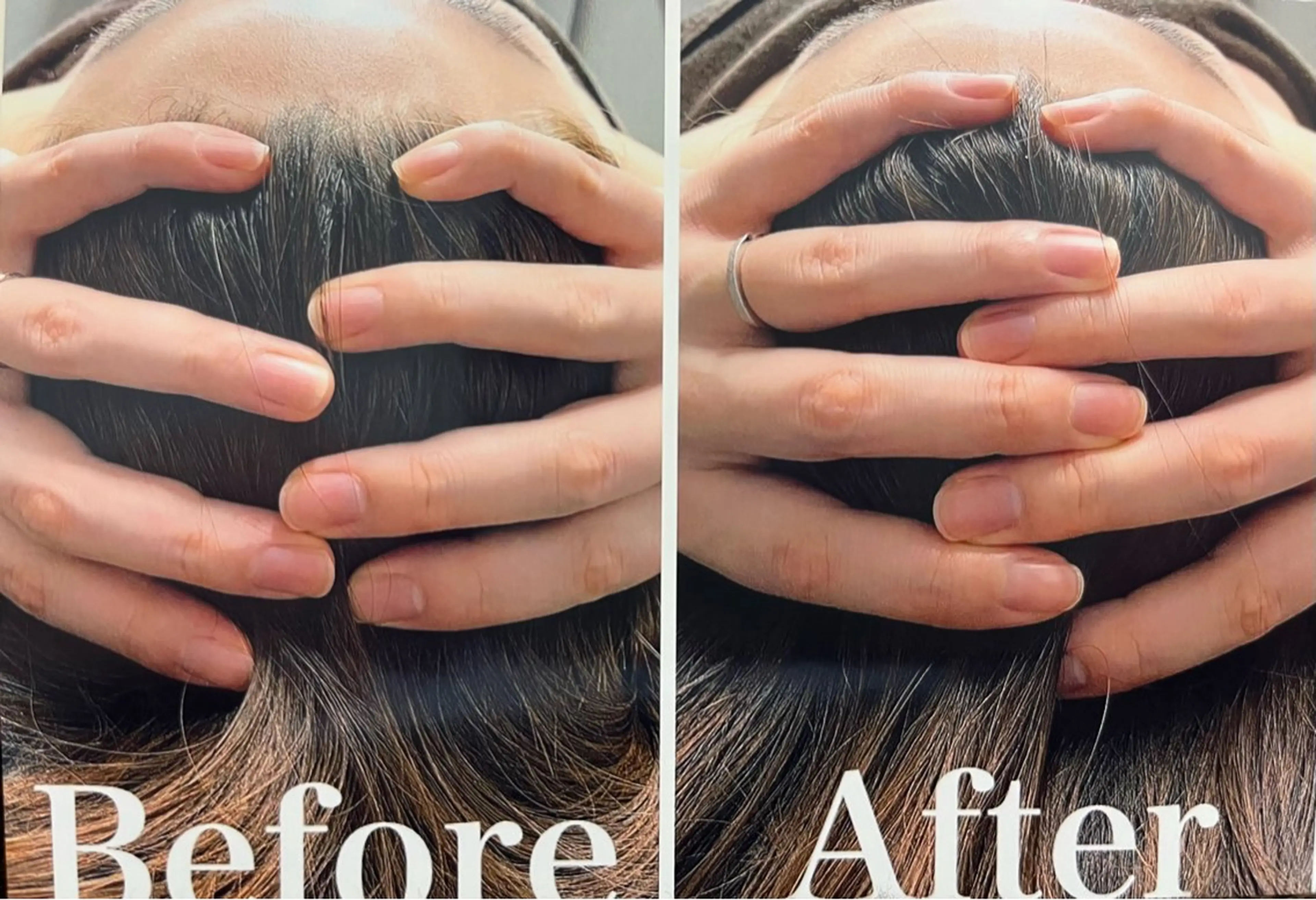 MIRAI小顔 溝の口店のエステ・リラクイメージ