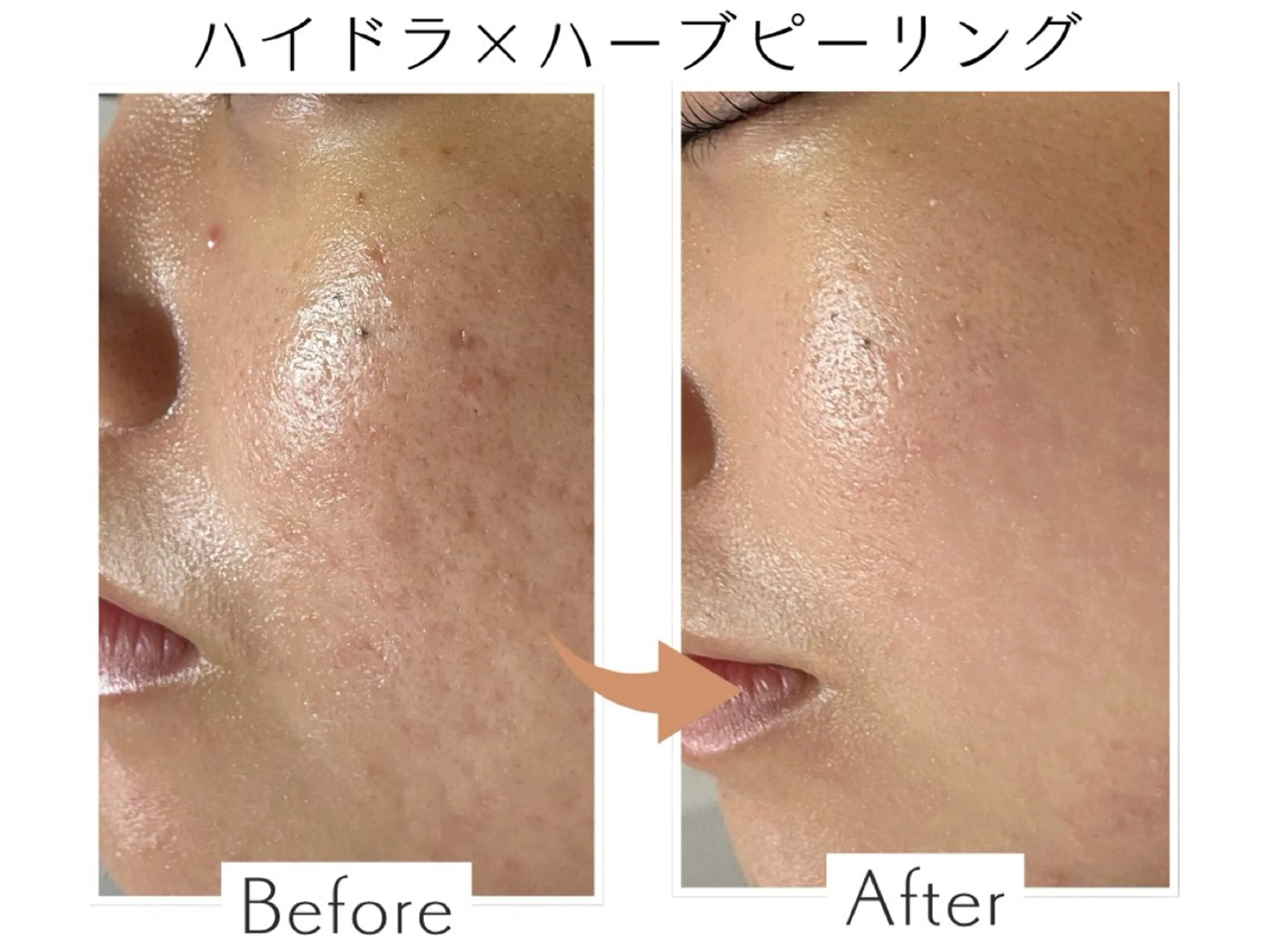 エステ プライベートサロン Belle（ベル）のエステ・リラクイメージ