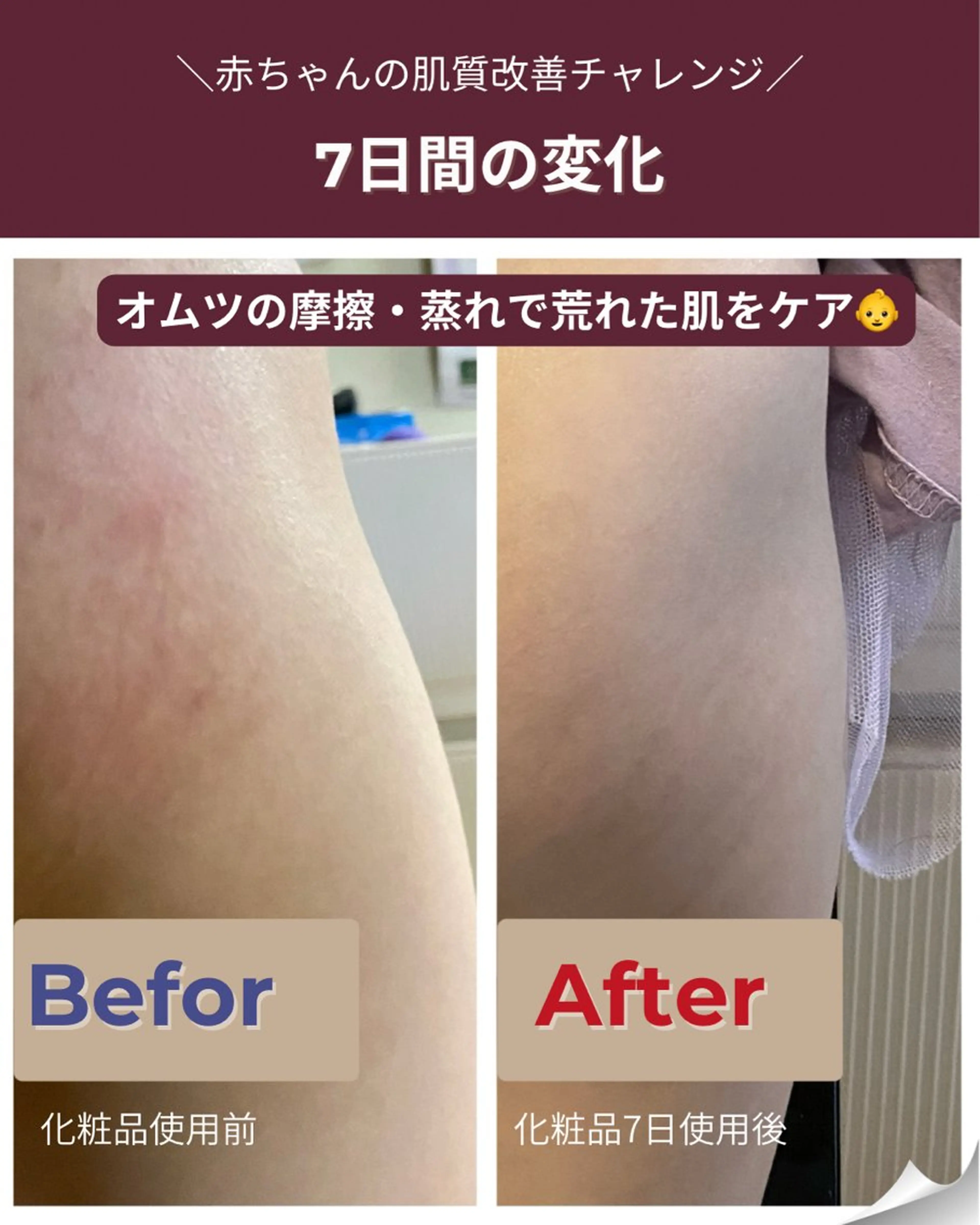 その他 肌質改善エステ RISMINのエステ・リラクイメージ