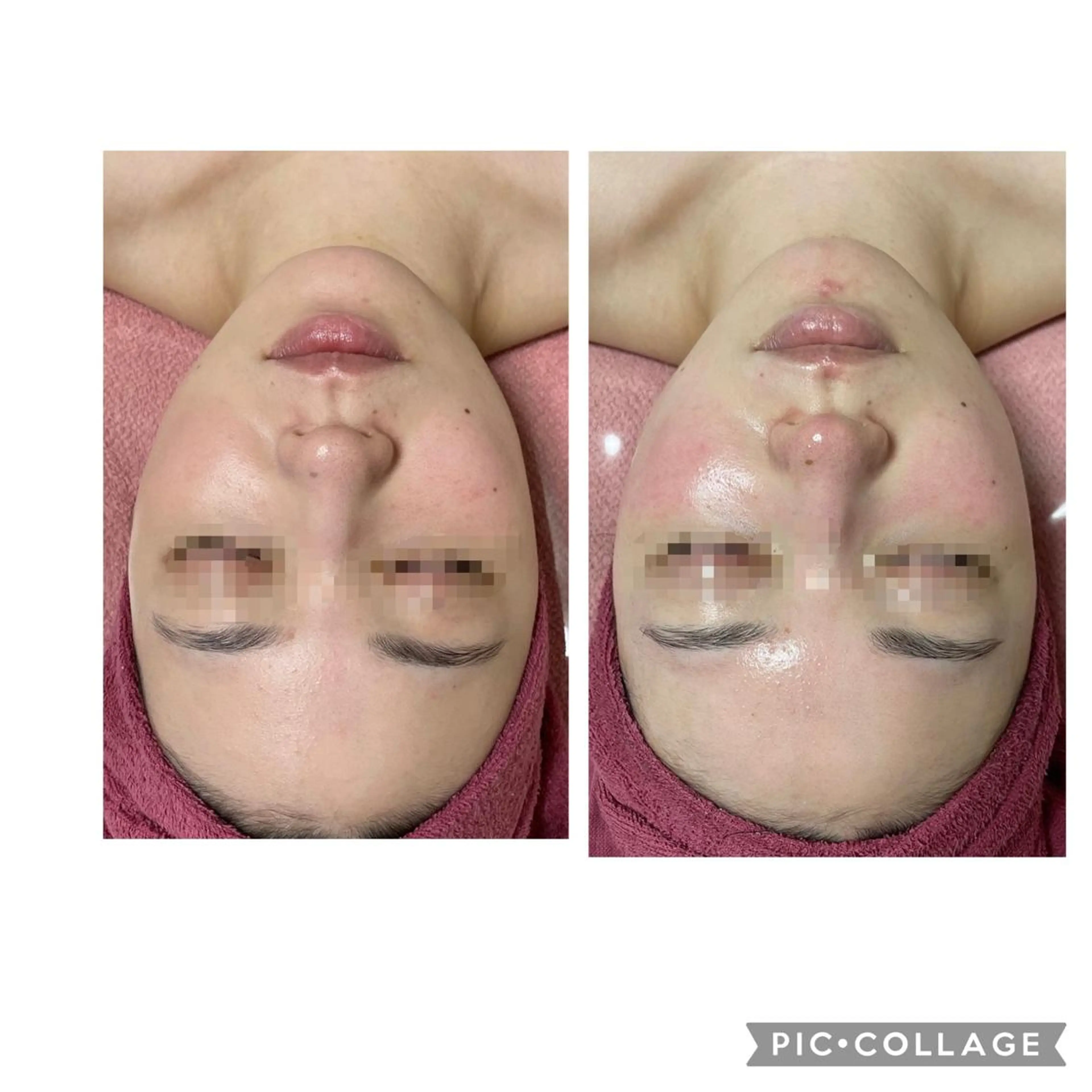 エステ 伊藤 順子のその他イメージ