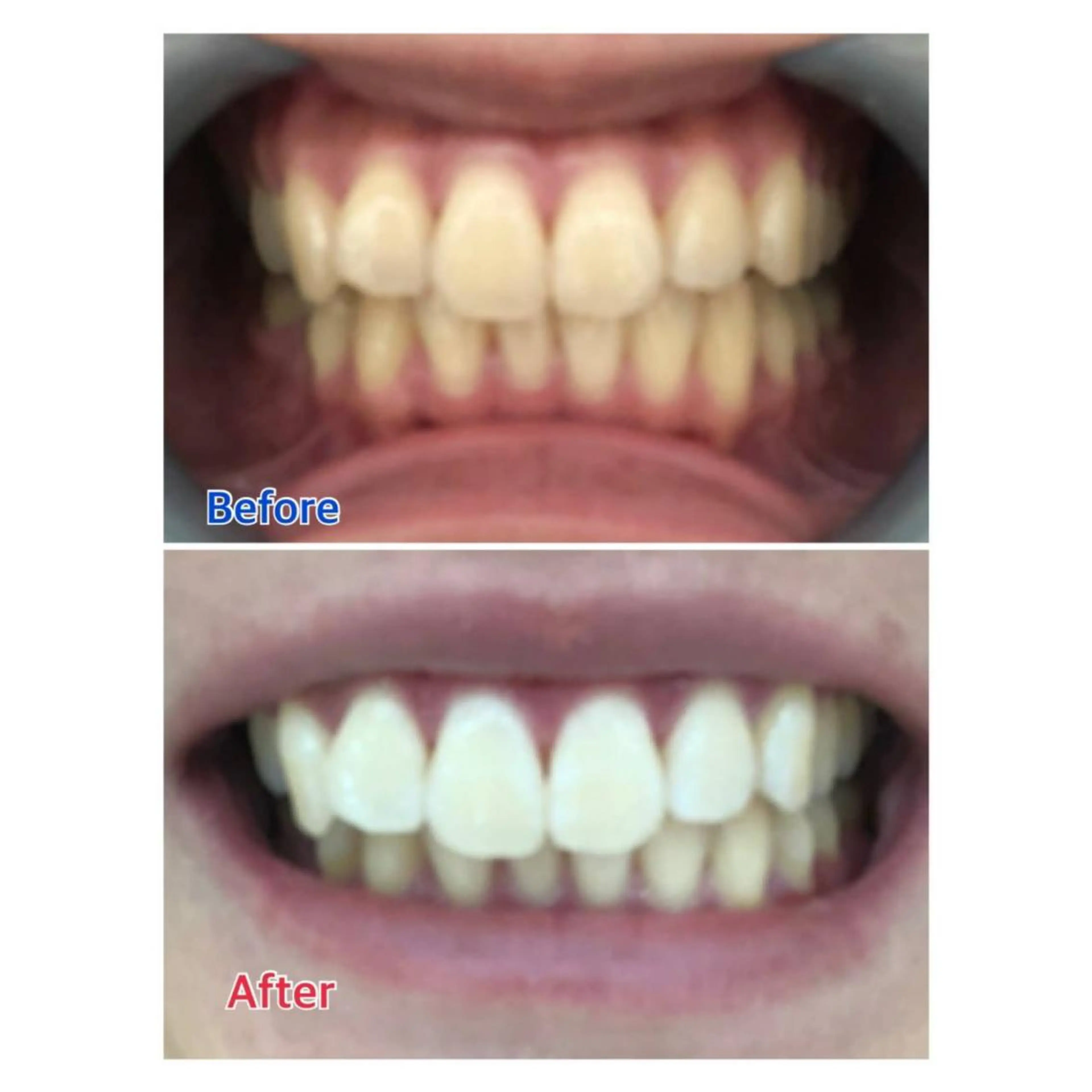 MBEAUTYSALON 千葉店・京成大久保所属・Melty 輝のその他イメージ