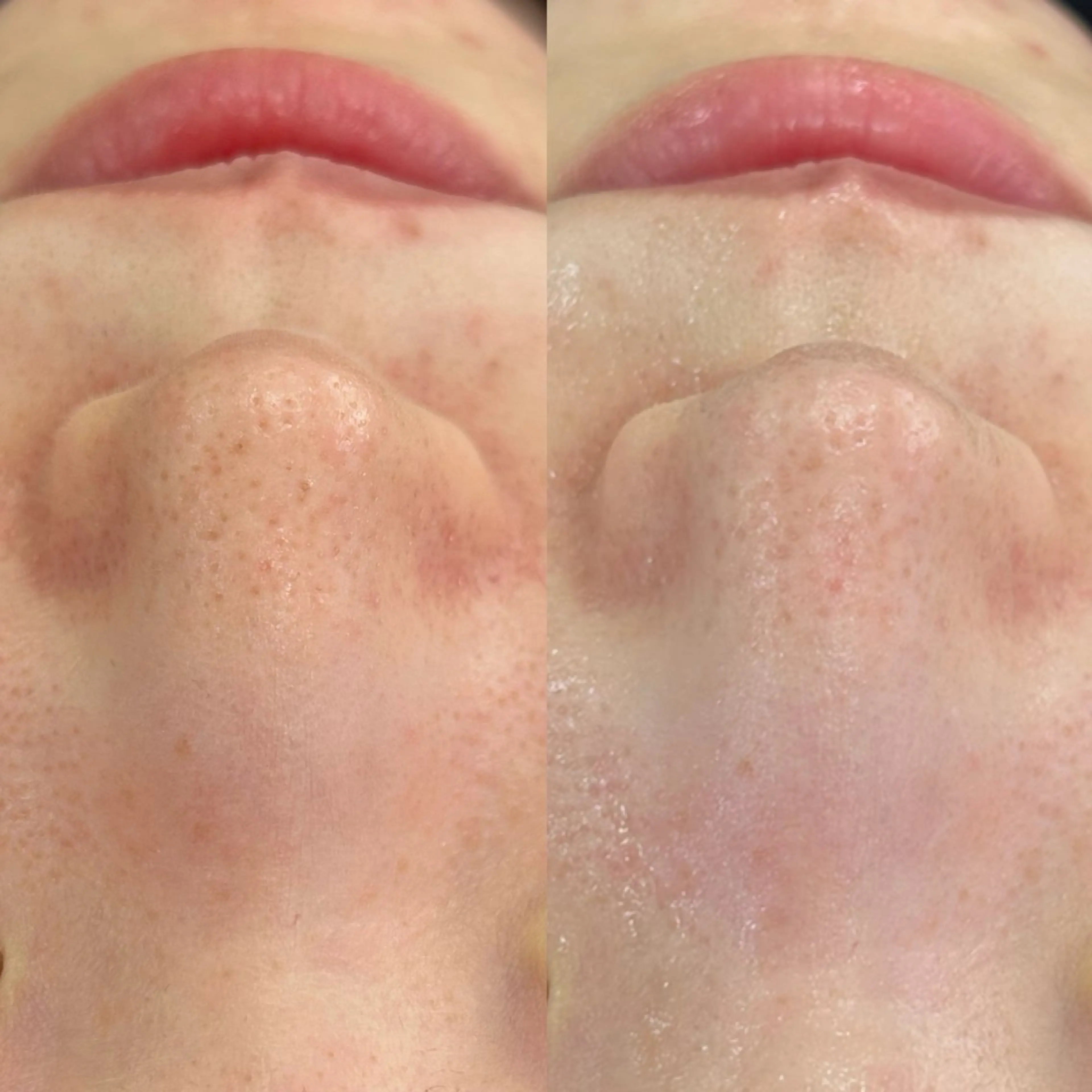 エステ Venus所属・エステサロン Venusのその他イメージ