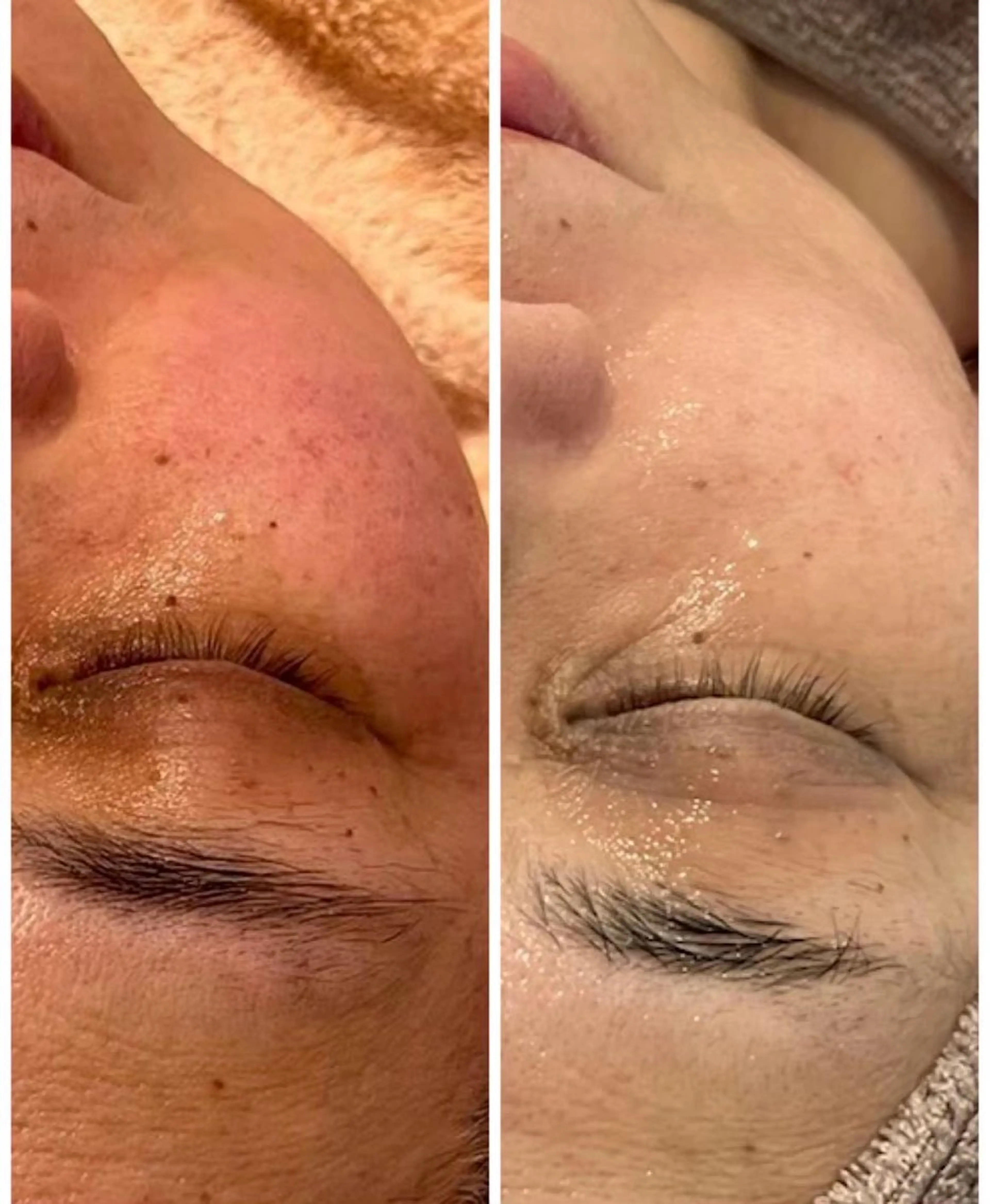 エステ エムフルール リラク＆エステのエステ・リラクイメージ