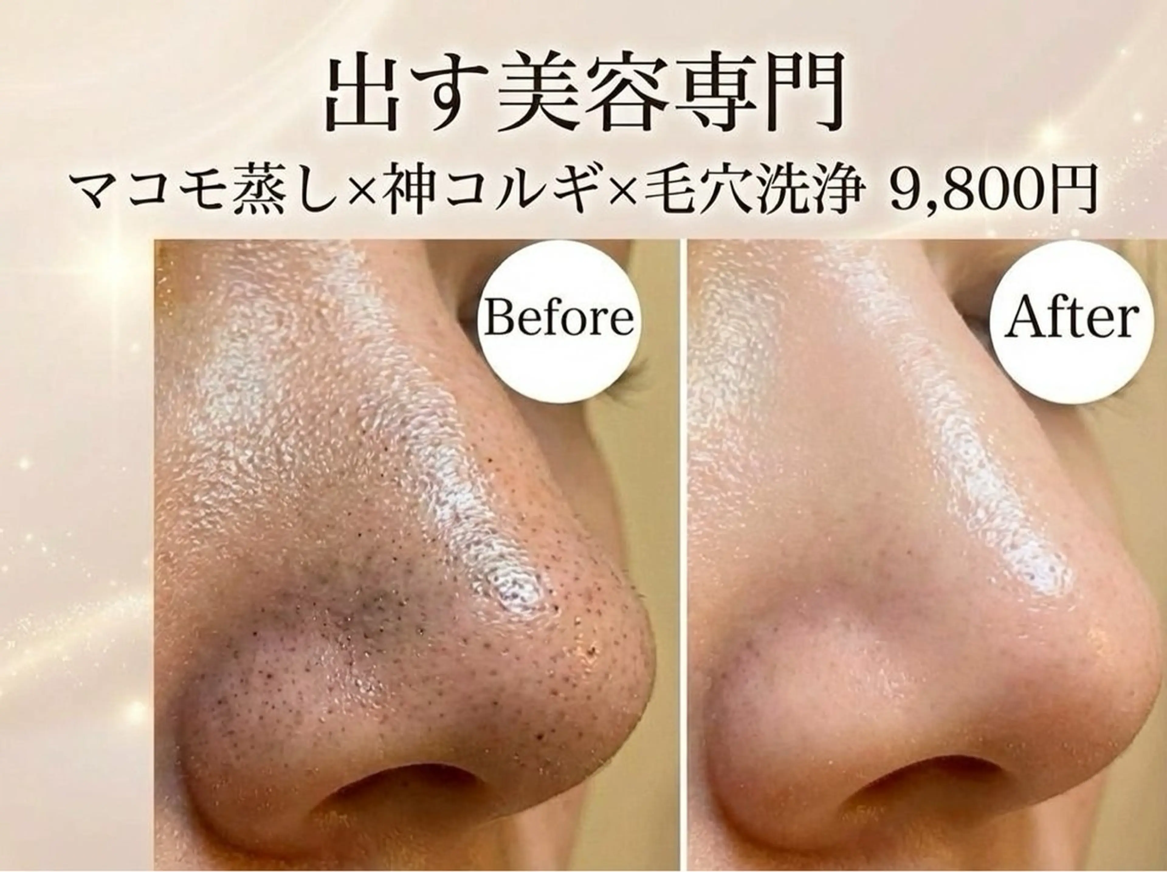 La cherieのエステ・リラクイメージ