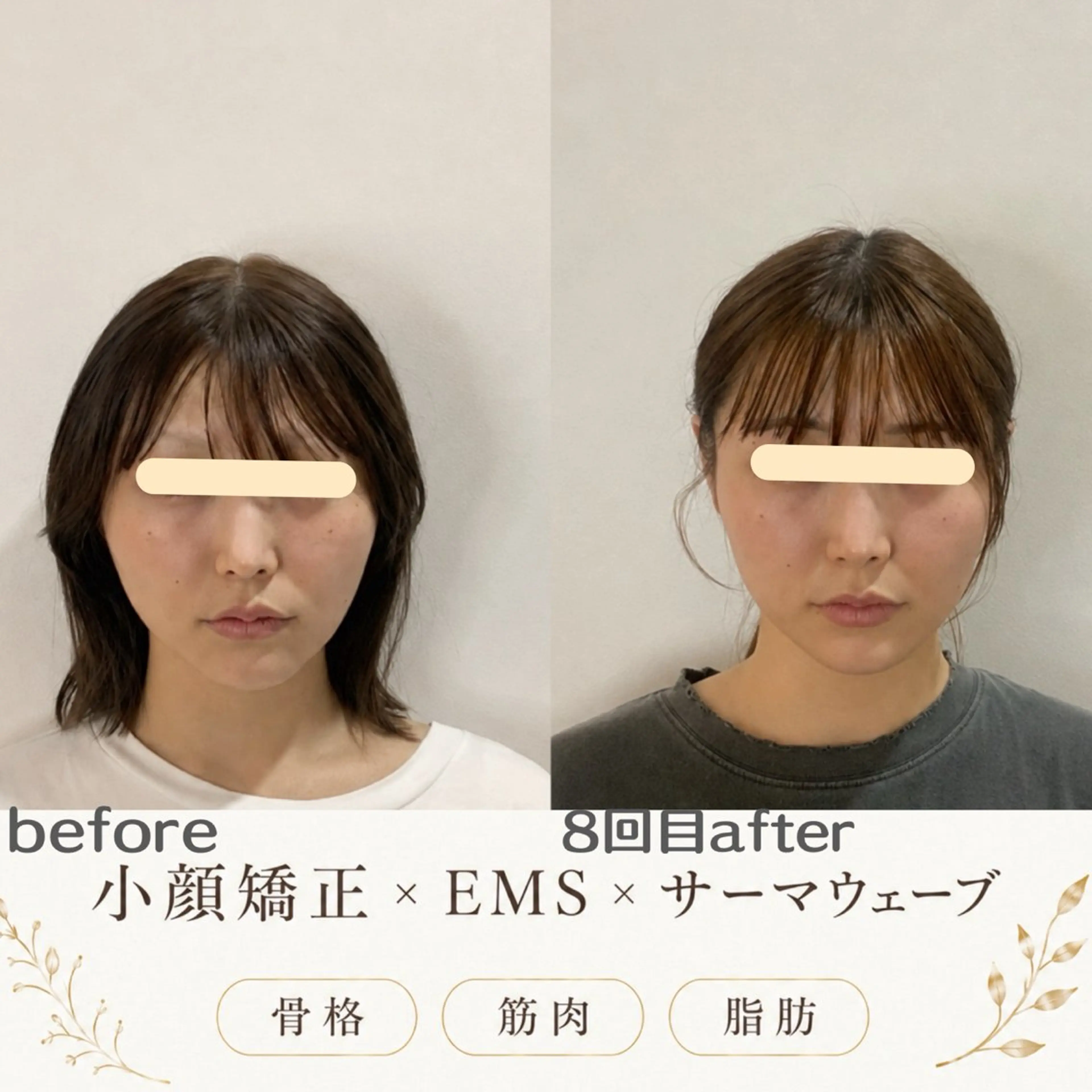 エステ リラク 最速小顔・肌質管理 espoirマキのエステ・リラクイメージ