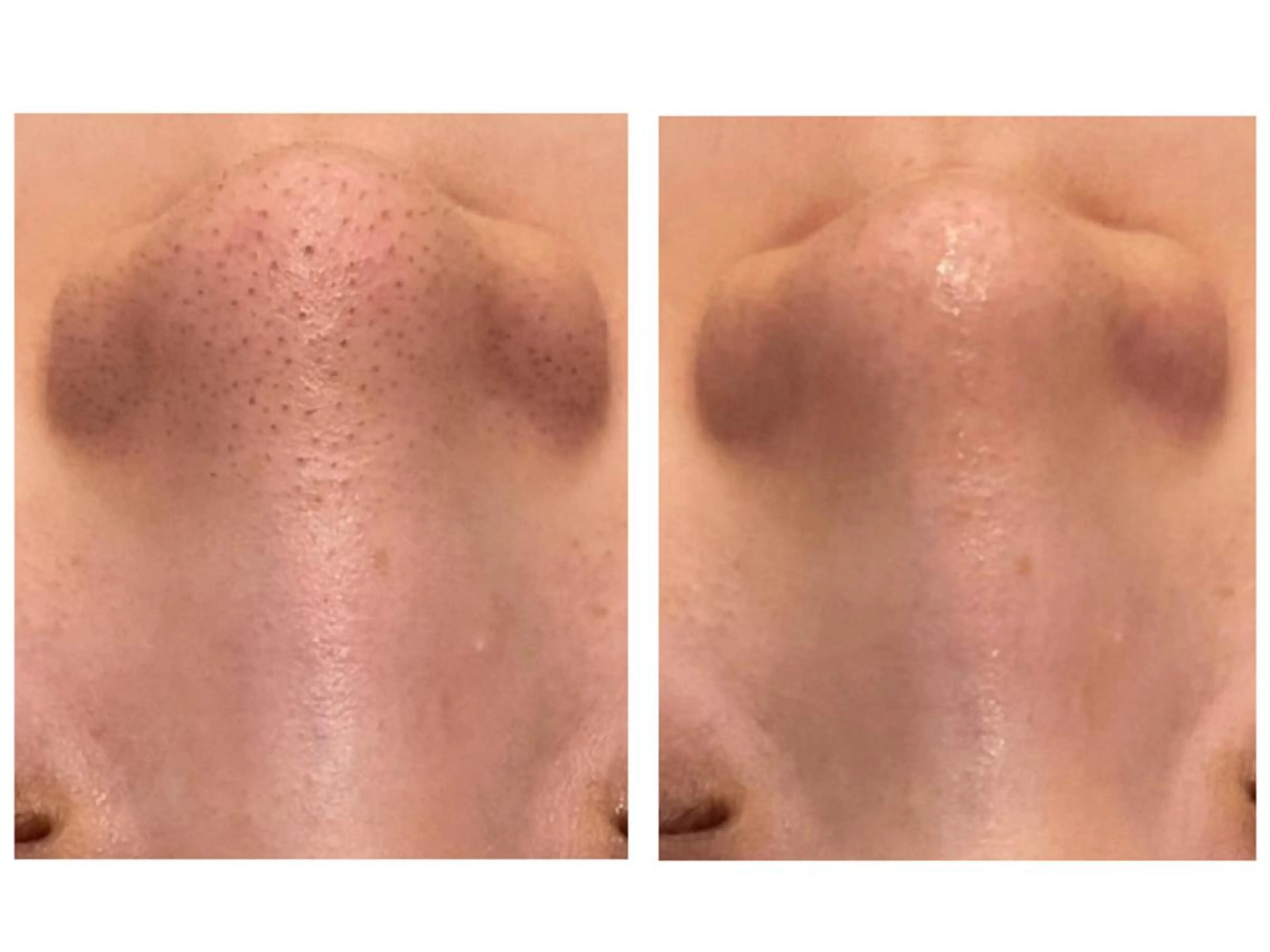 レイビス名古屋♡ 川北♡U24のエステ・リラクイメージ