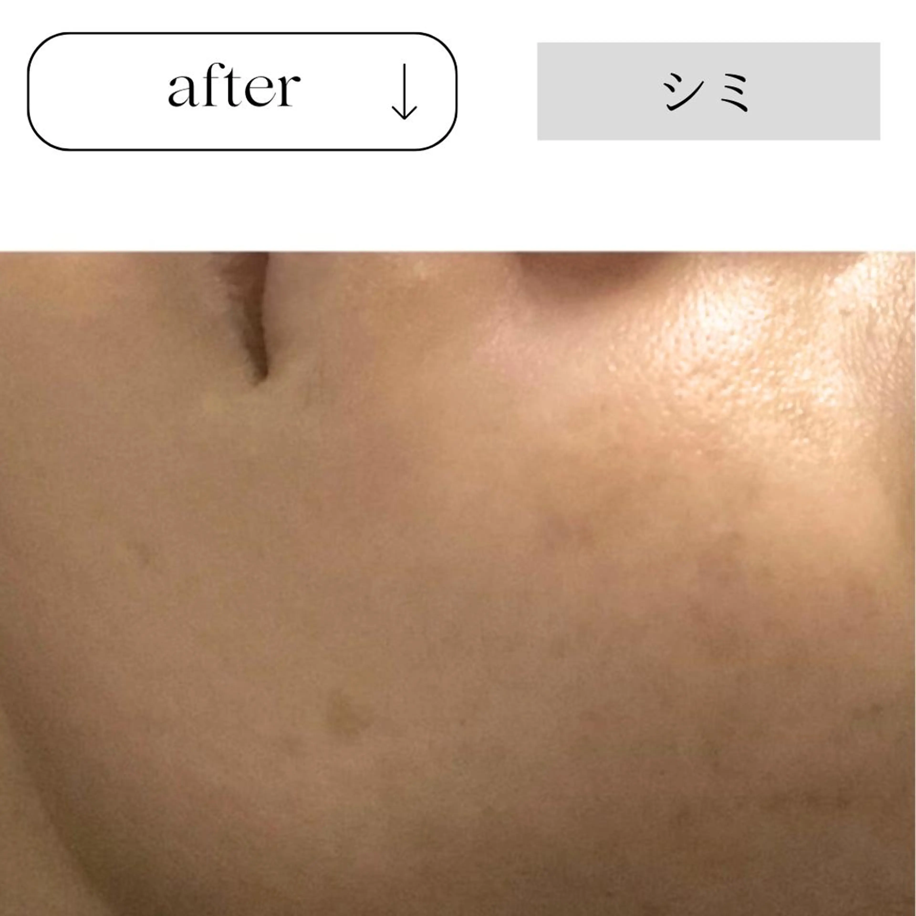 エステ beauty CHOOSEのエステ・リラクイメージ