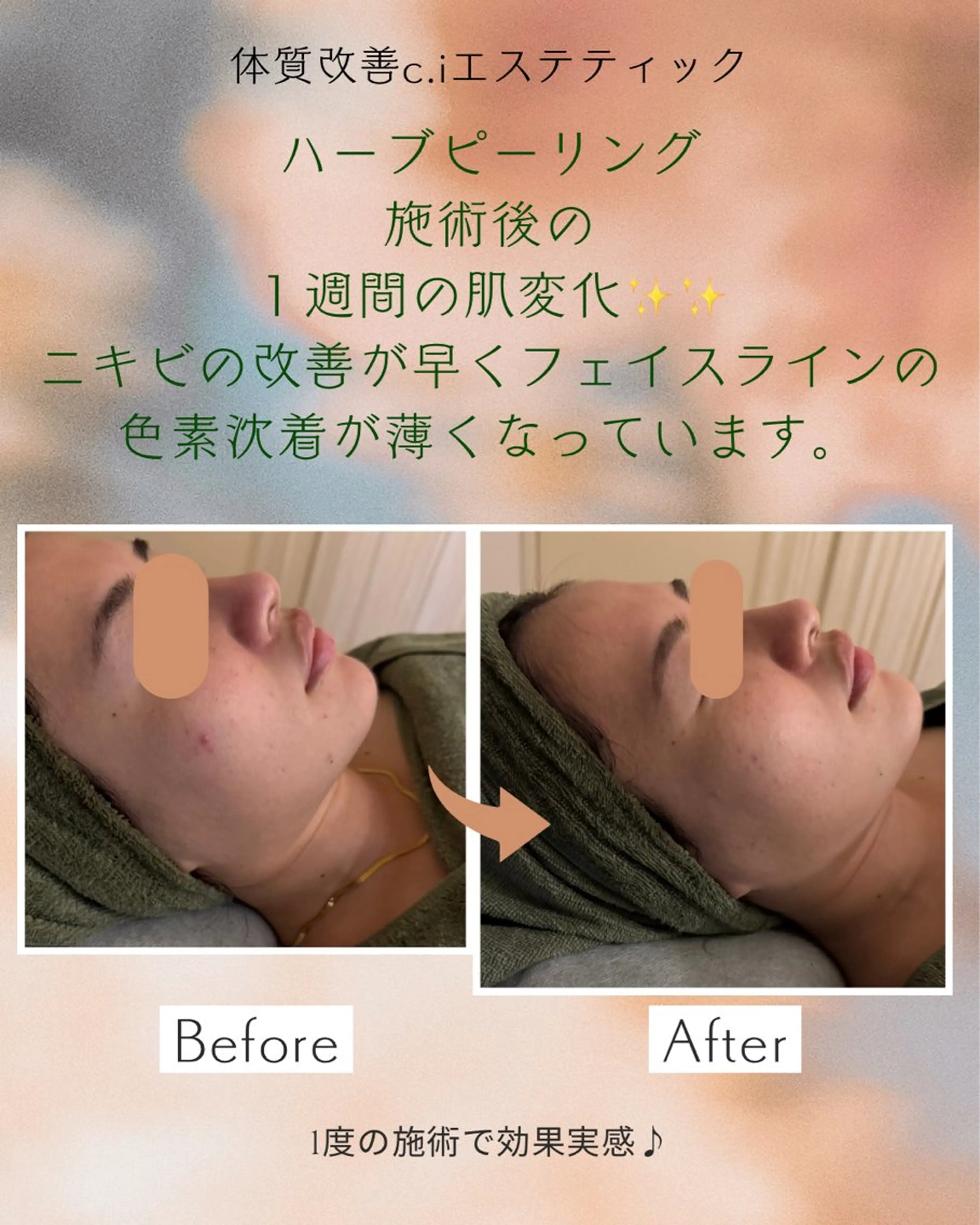 睡眠の質／体質改善 c.iエステティックのエステ・リラクイメージ