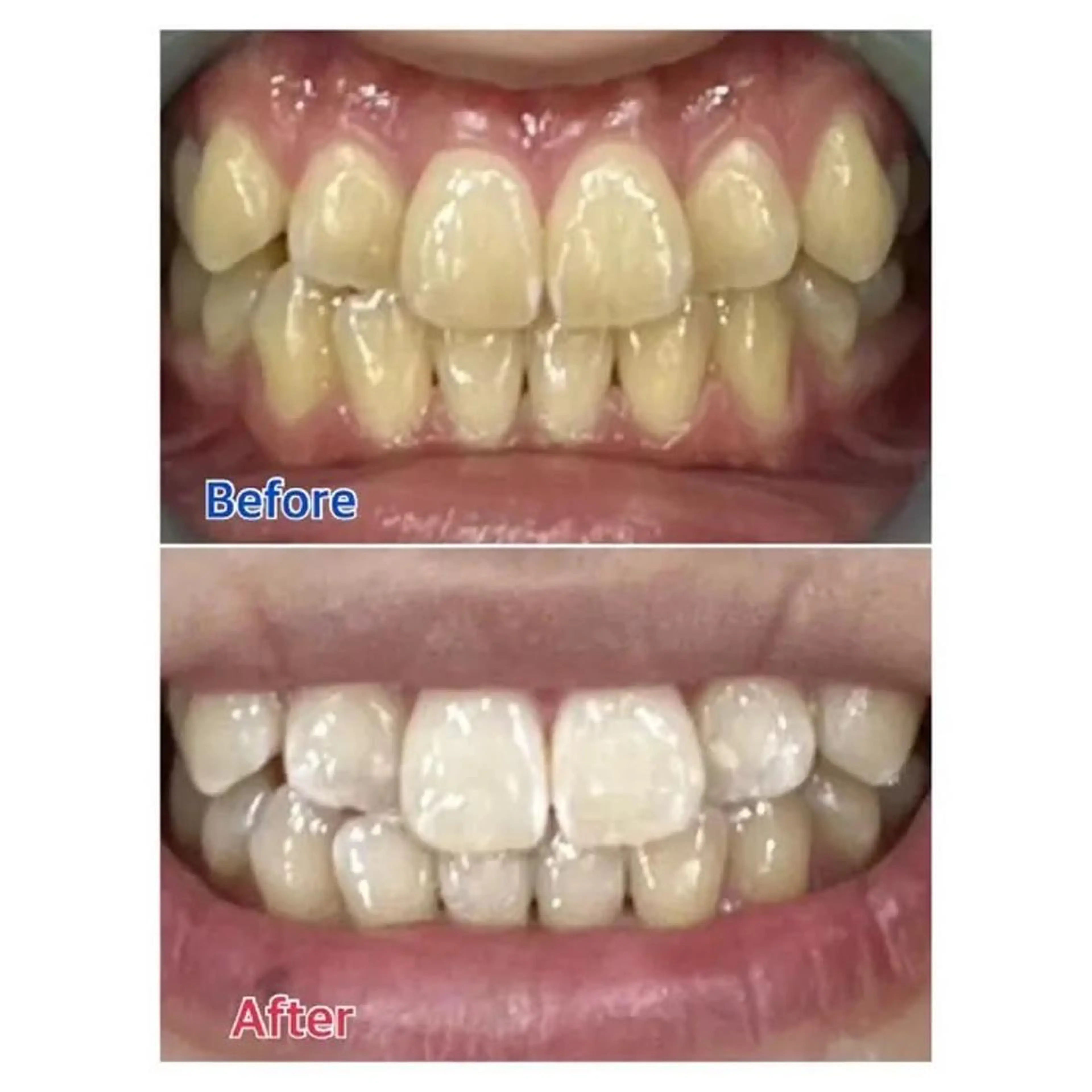 M渋谷 ホワイトニングのその他イメージ