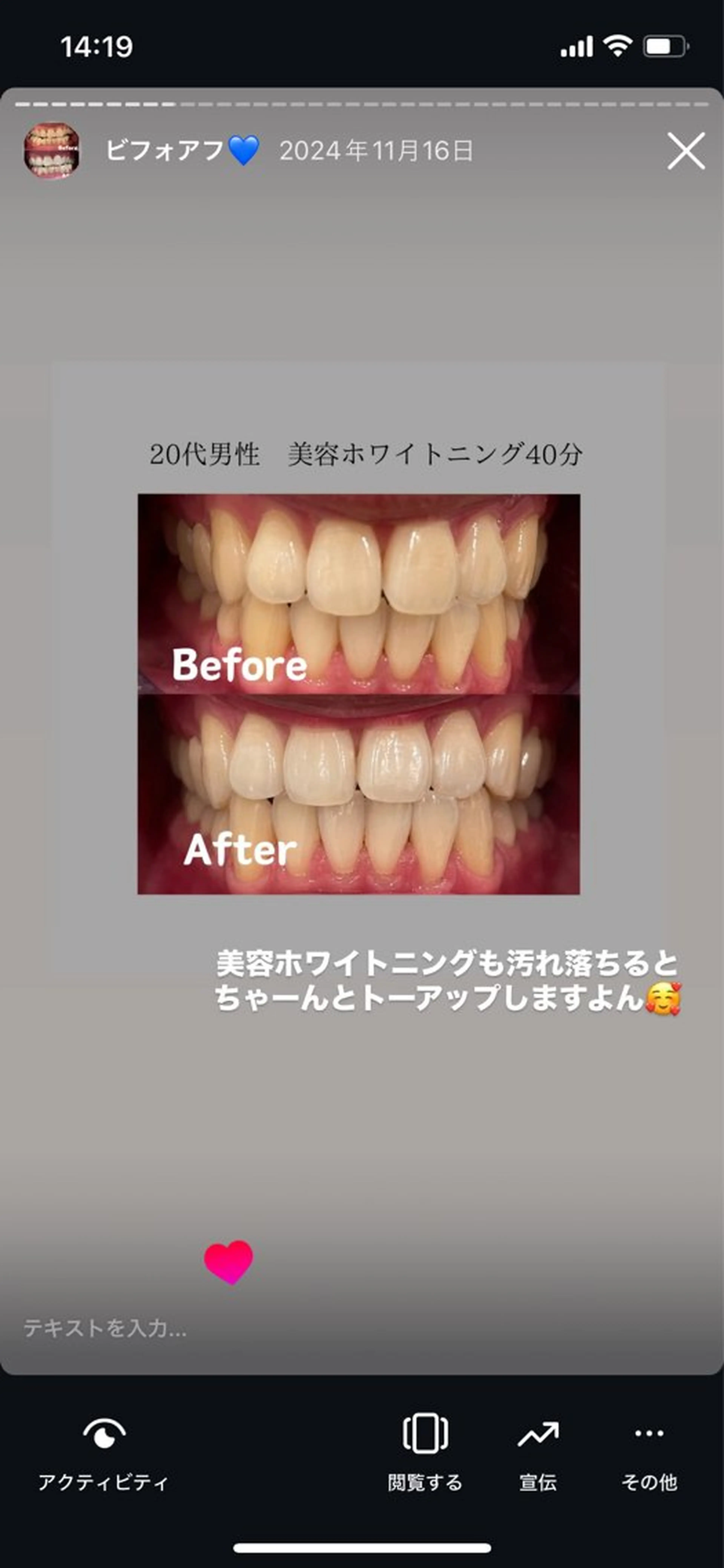 Kaula ホワイトニング🦷✨のエステ・リラクイメージ