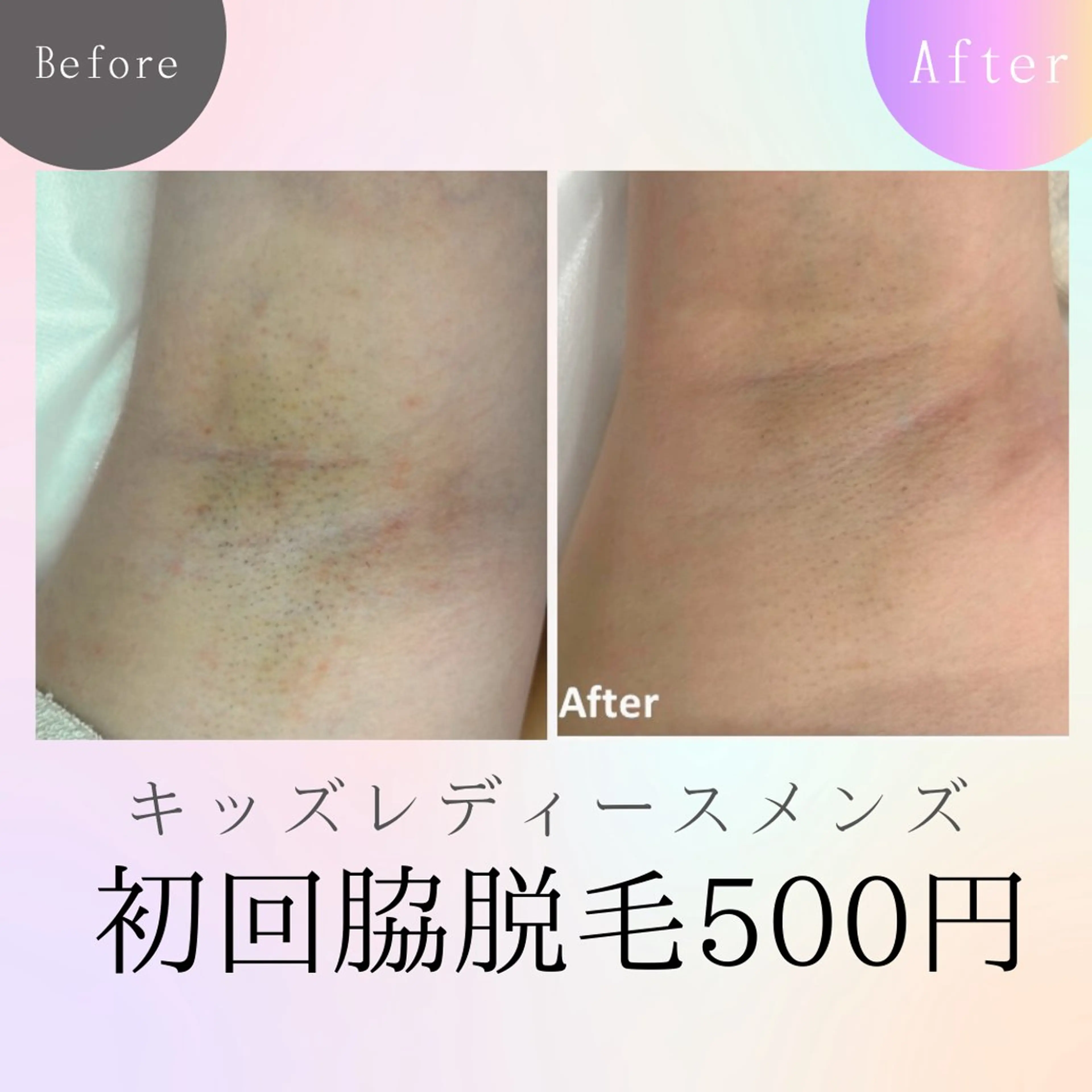 メンズ キッズ 脱毛 エステサロン さらのエステ・リラクイメージ