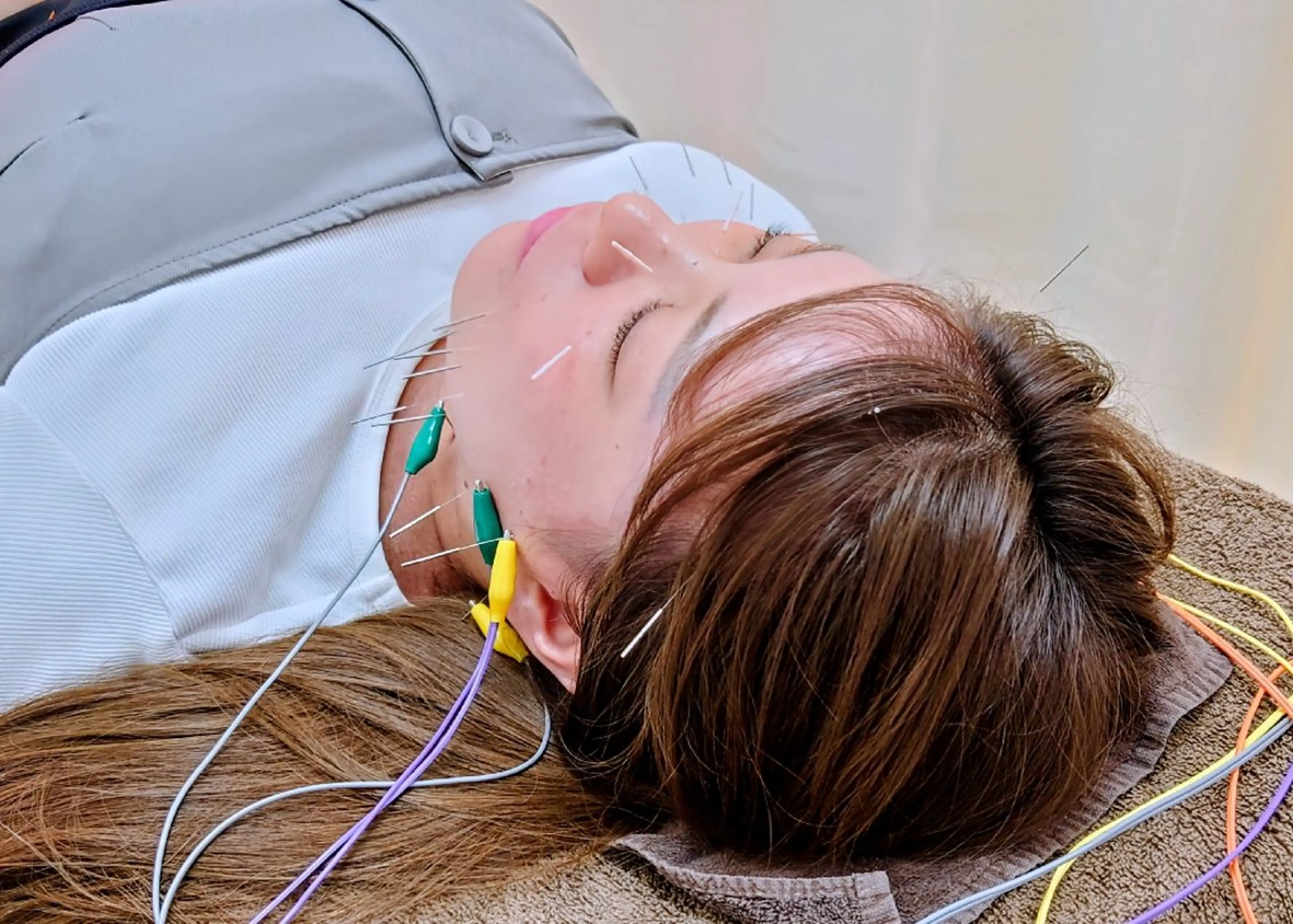 スカイブルー 鍼灸接骨院　佐々木のエステ・リラクイメージ