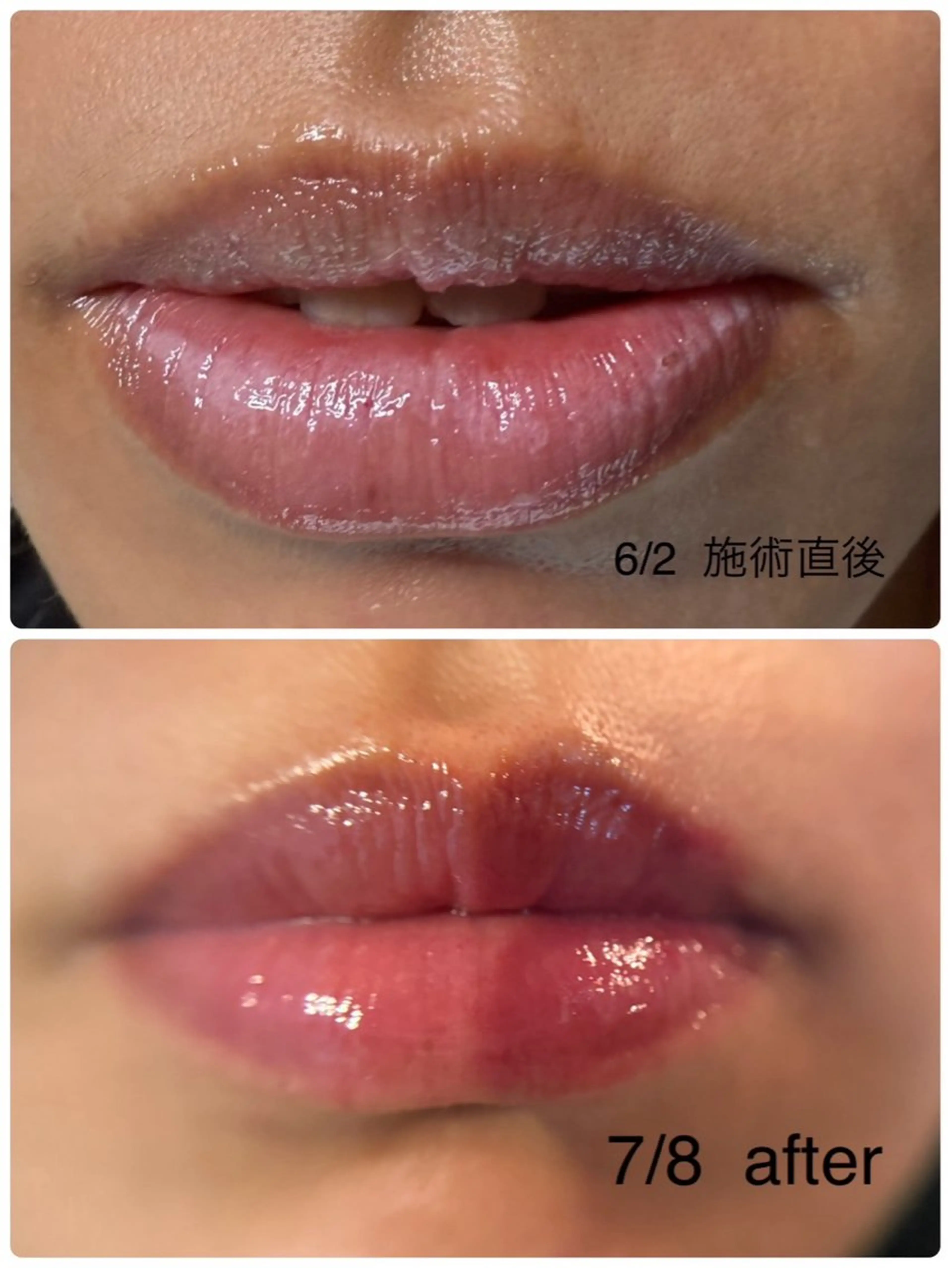 A.所属・Raviy(A.) 【痩身・韓国肌管理】のエステ・リラクイメージ