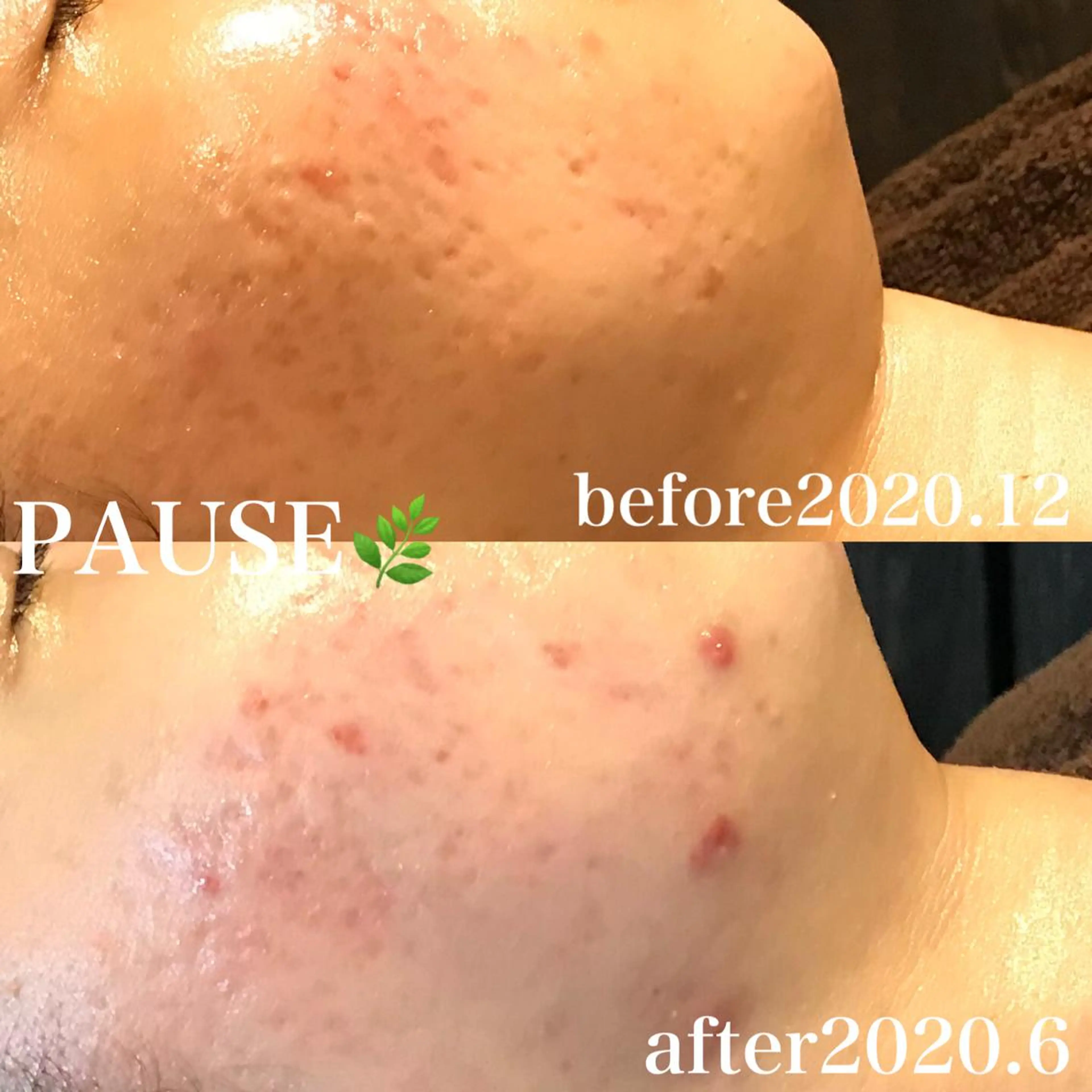 エステ 浜野 恵美のエステ・リラクイメージ