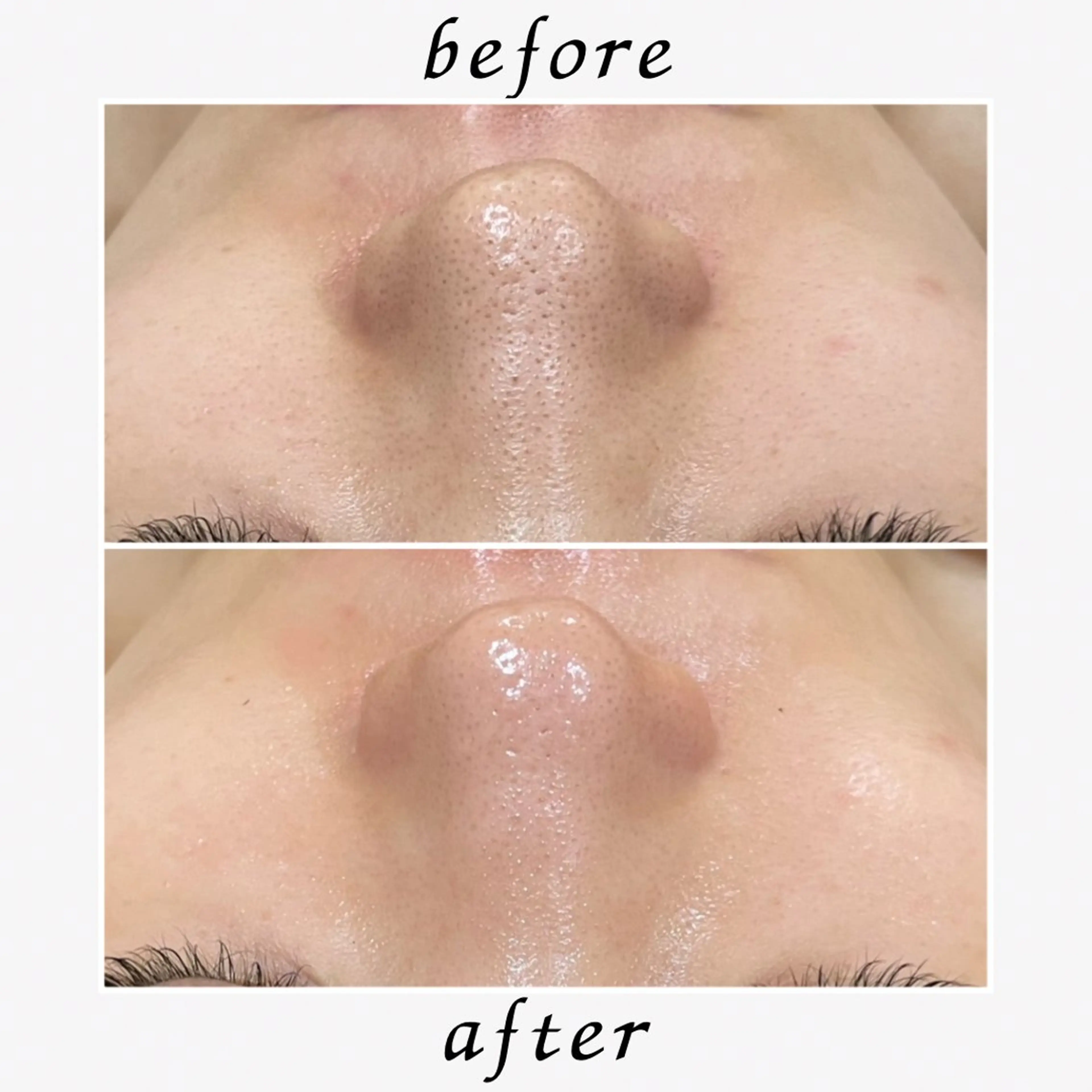 エステ フェイシャル/脱毛 ジョアアンジェ　田中のエステ・リラクイメージ