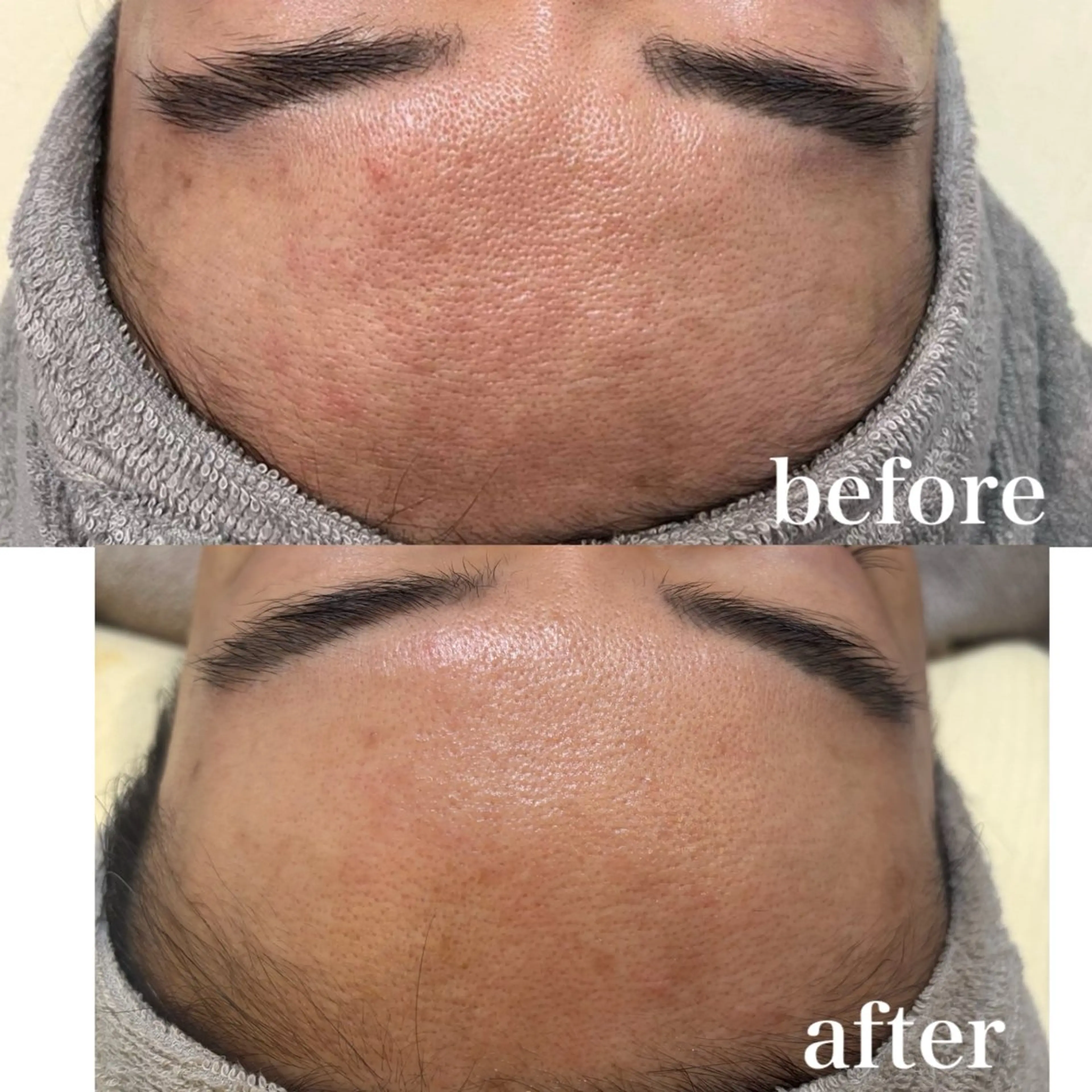 unsui spa 渋谷区神泉のエステ・リラクイメージ