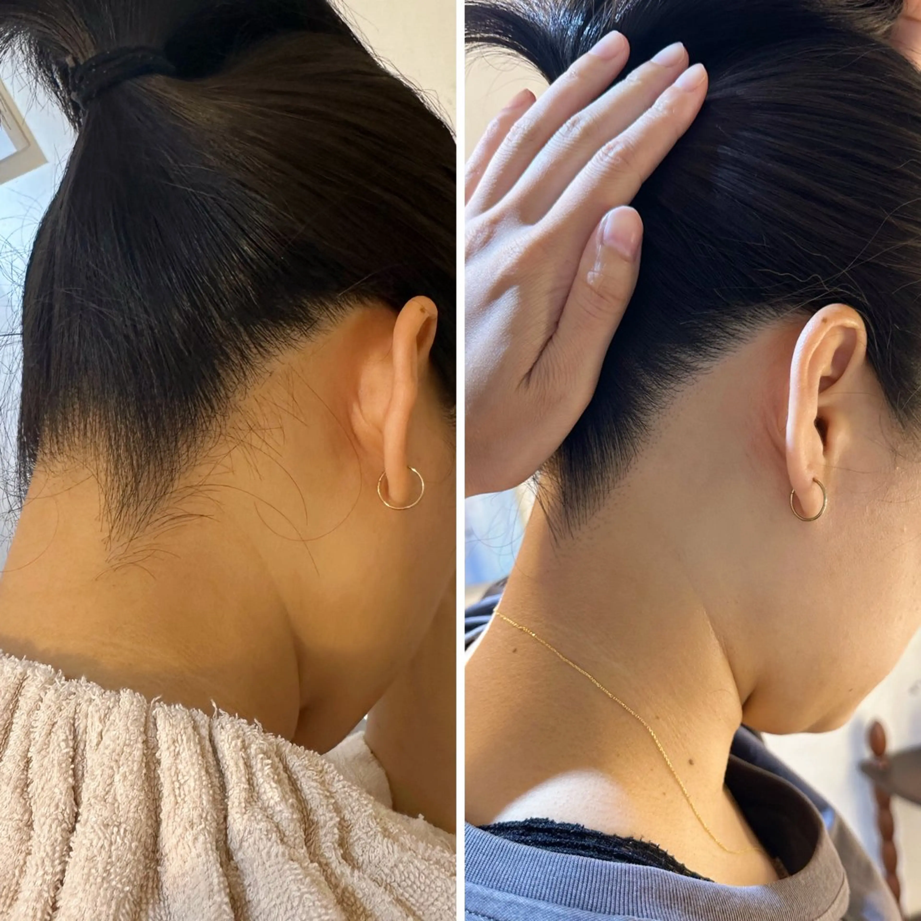 脱毛 うなじ脱毛/美肌脱毛 LABELのエステ・リラクイメージ