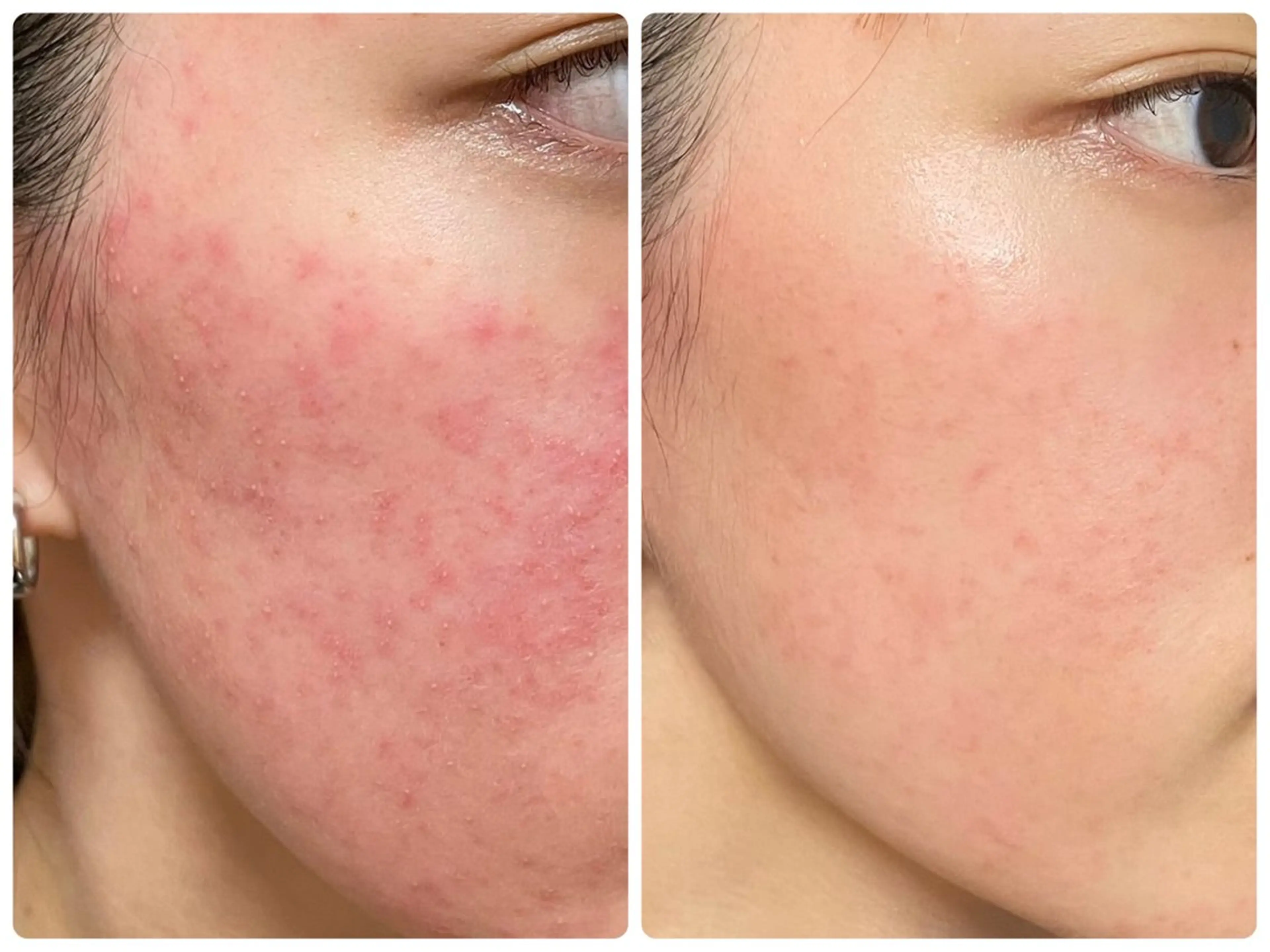 エステ Liberte リベルテ(トモ化粧品店内)所属・Liberte’/ rinaのマツエク・マツパデザイン