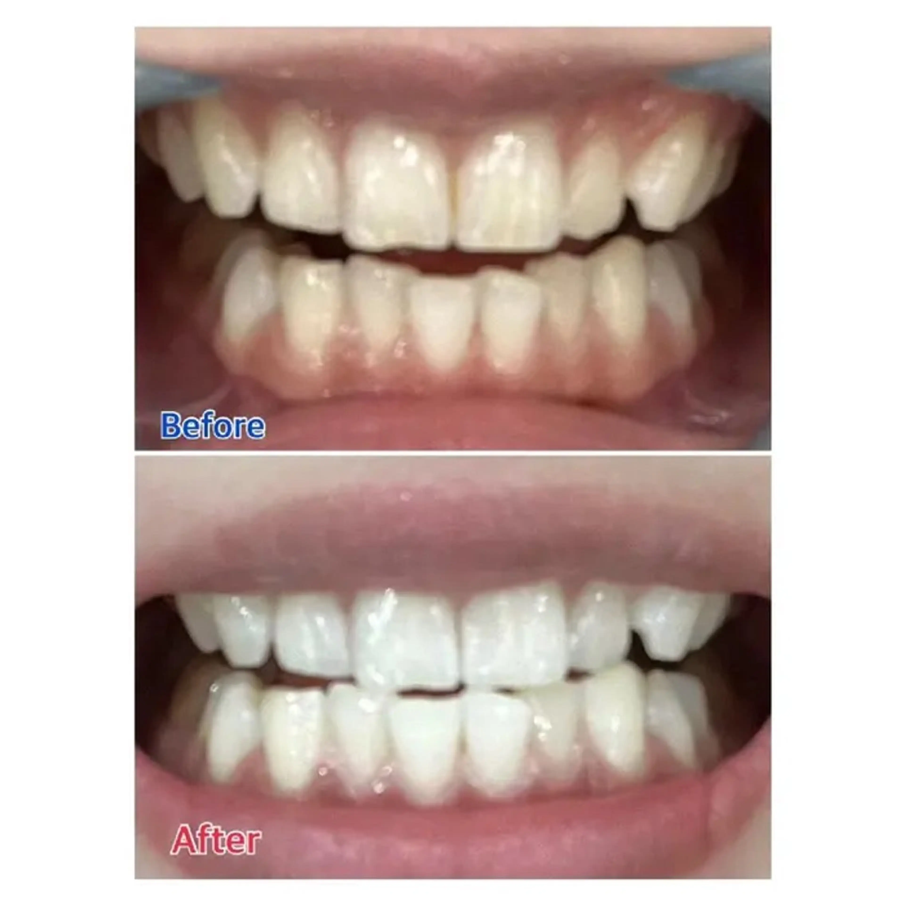 M渋谷 ホワイトニングのエステ・リラクイメージ