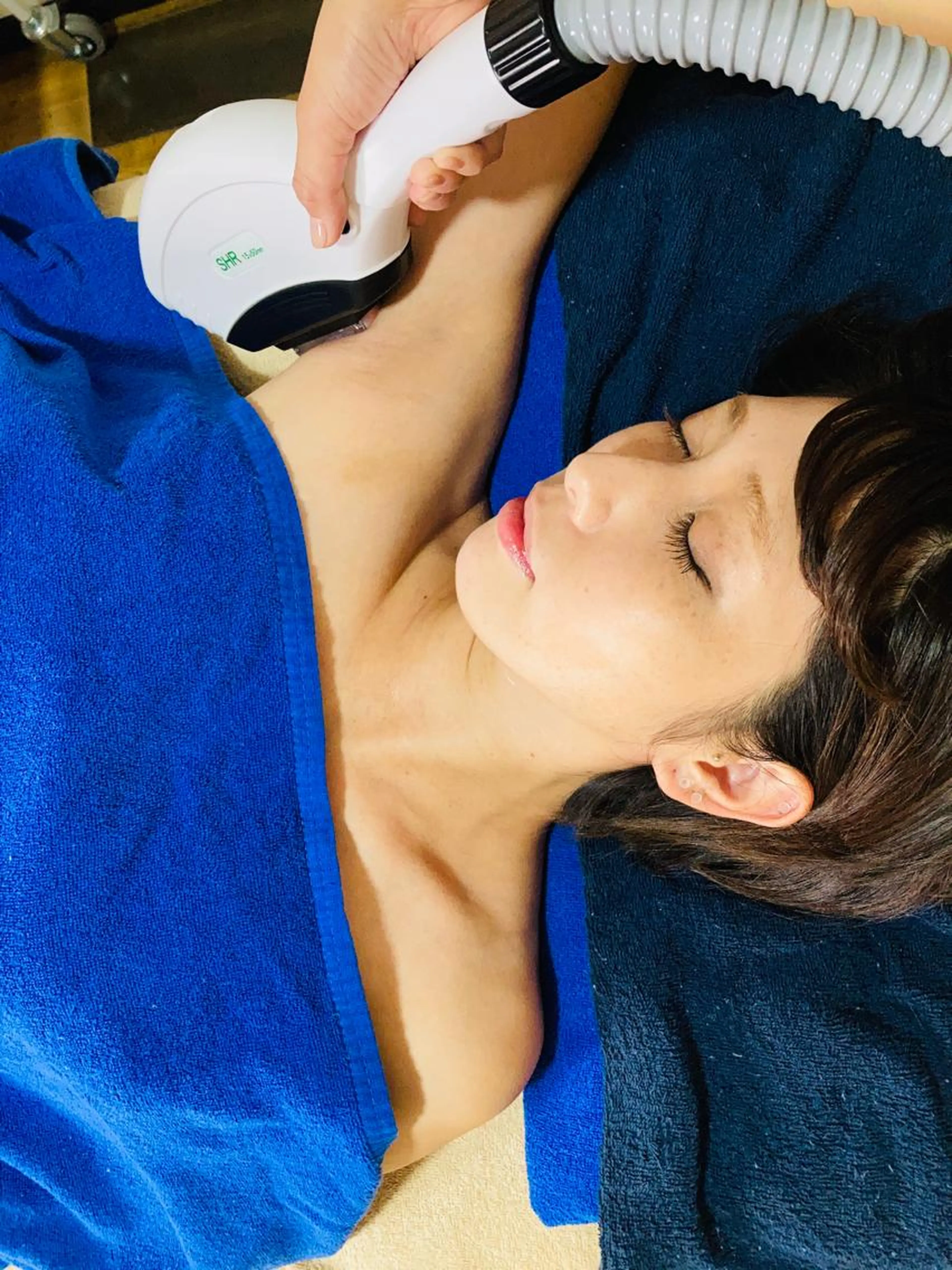 【痛み極小HIPL脱毛】まずは脇脱毛をやってみたい！の写真