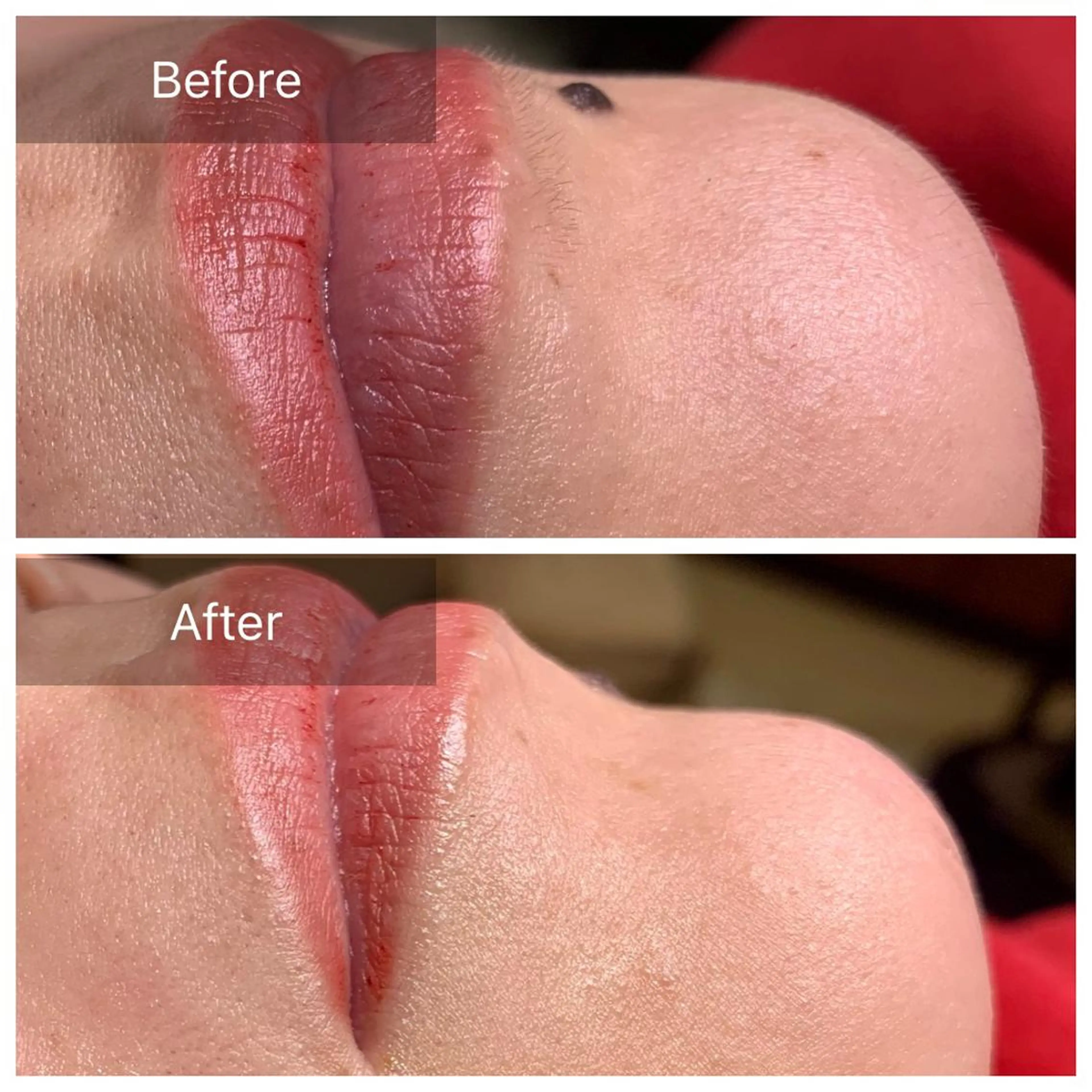 脱毛 Eminy. HITOMIのエステ・リラクイメージ