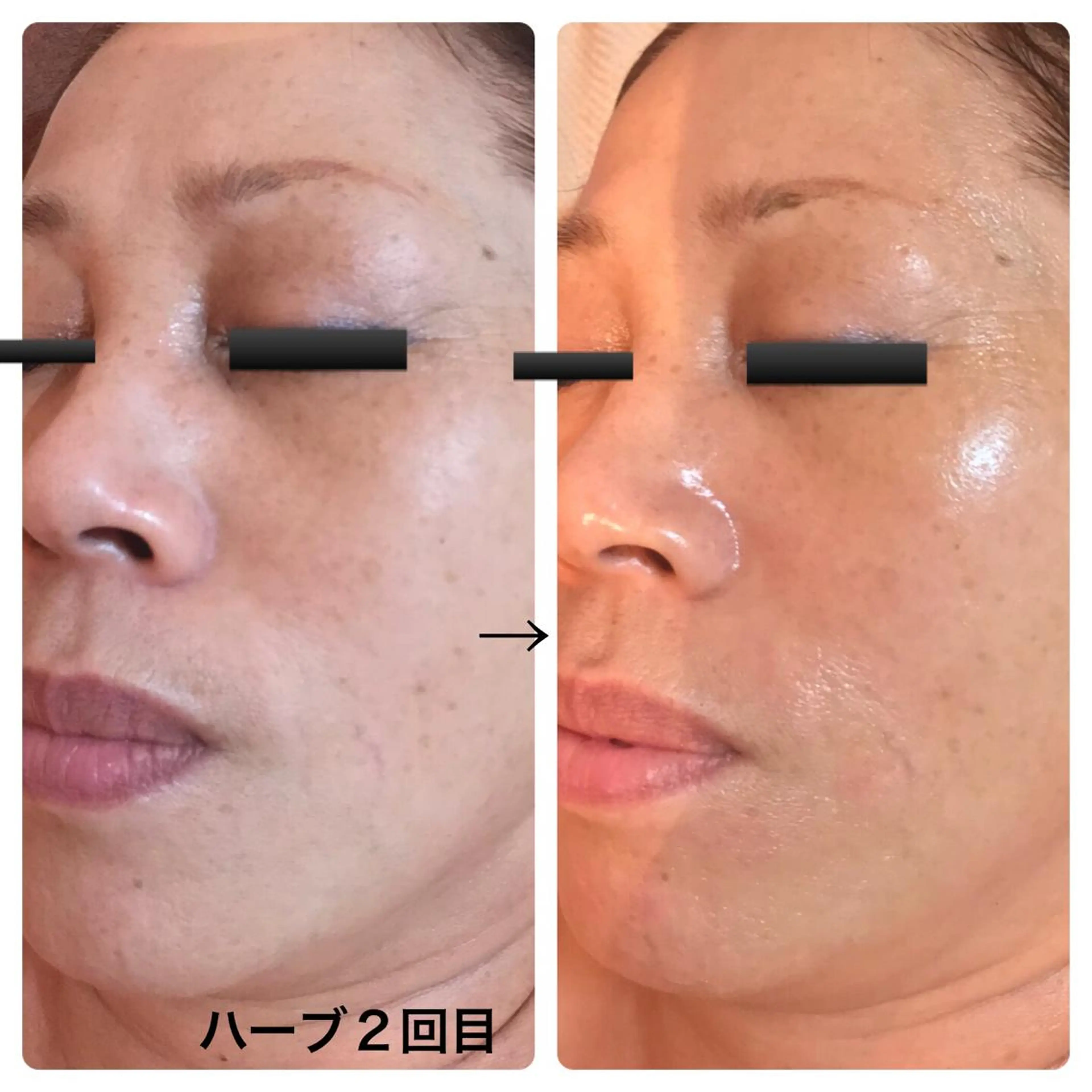 fairyrose organicエステのエステ・リラクイメージ