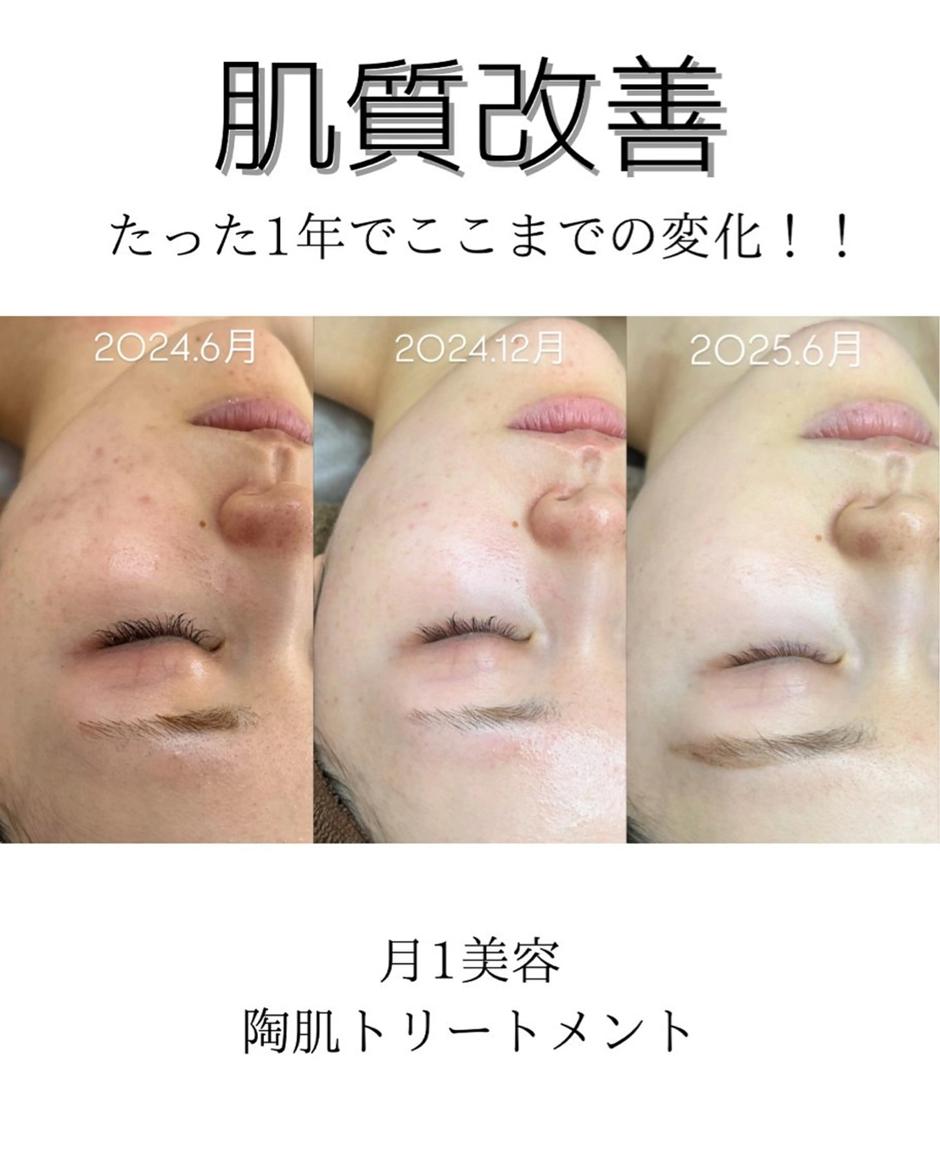 エステ 渡邊 千夏のエステ・リラクイメージ