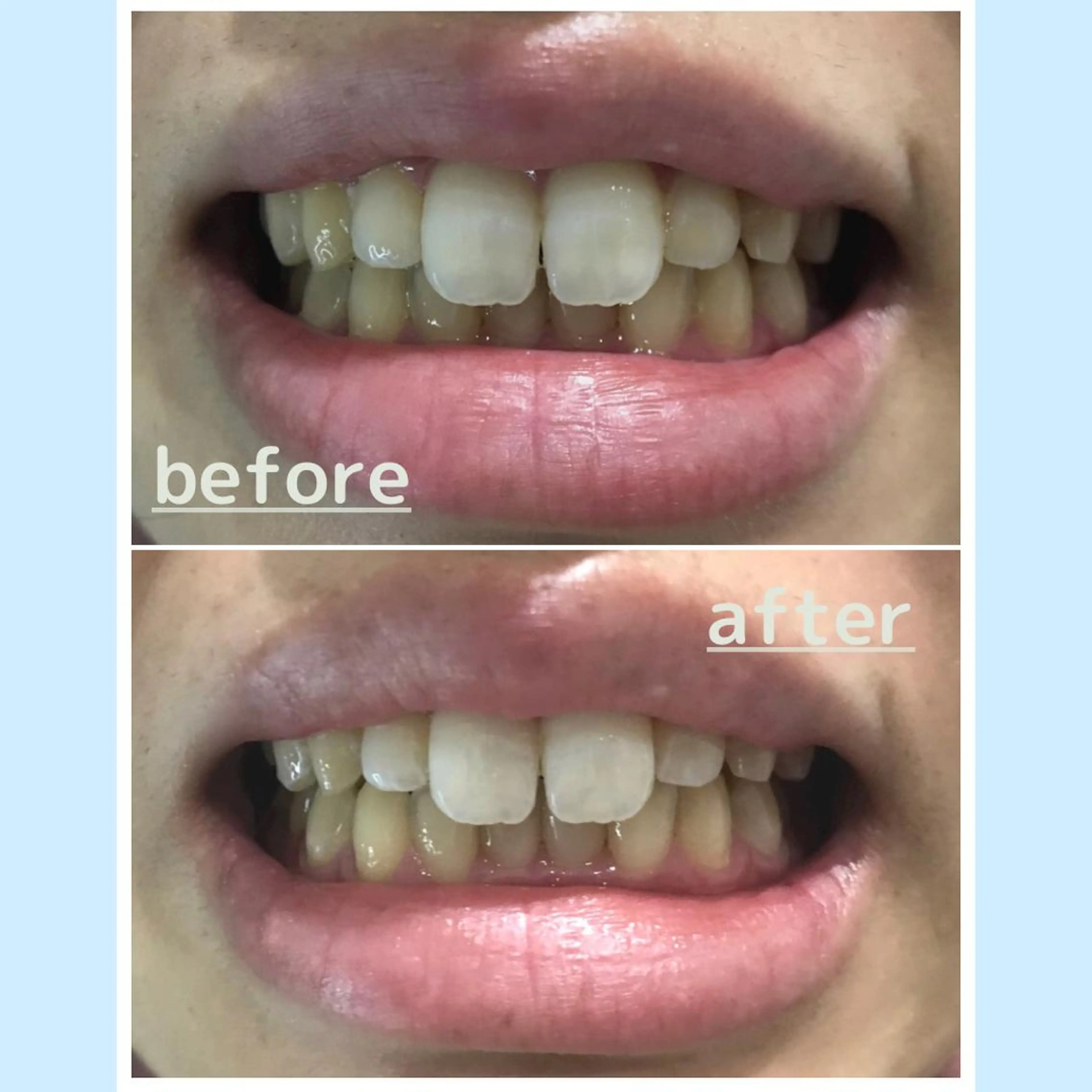 お手軽ホワイトニングsalon mina所属・武元 奈津美のその他イメージ