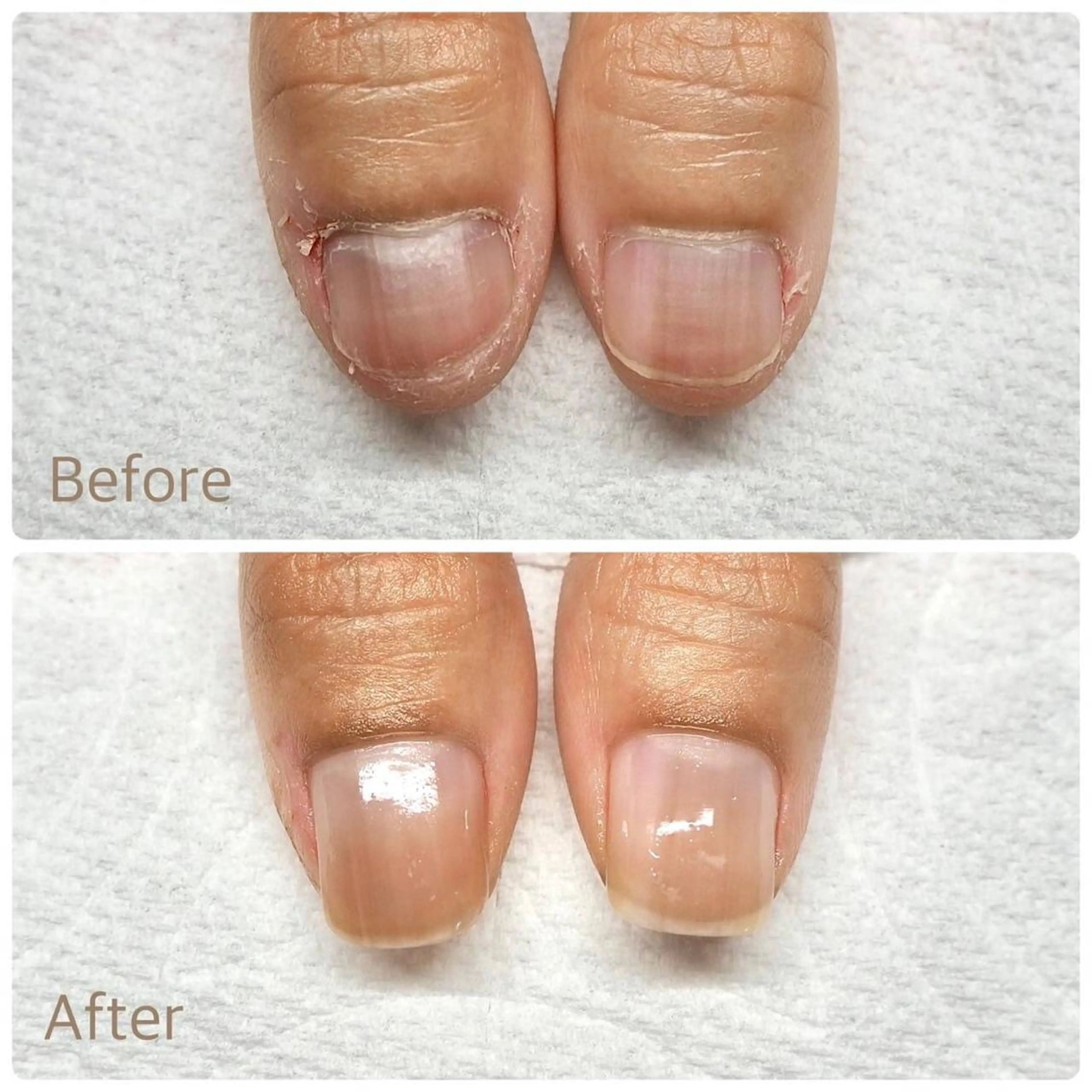 地爪育成お試しメニュー6600円→5500円(体験メニュー)の写真