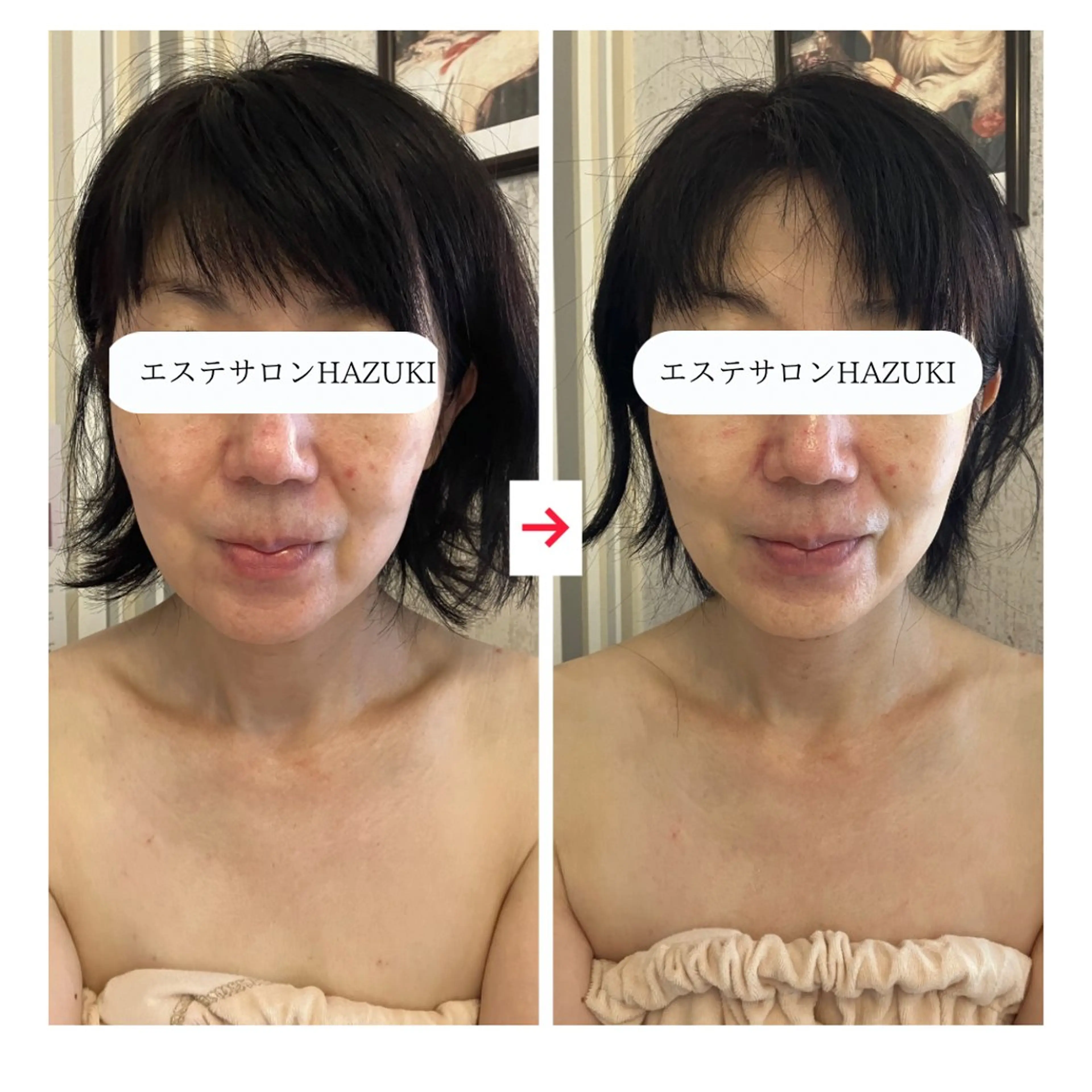 その他 たるみ改善小顔エステ 堀葉月のその他イメージ
