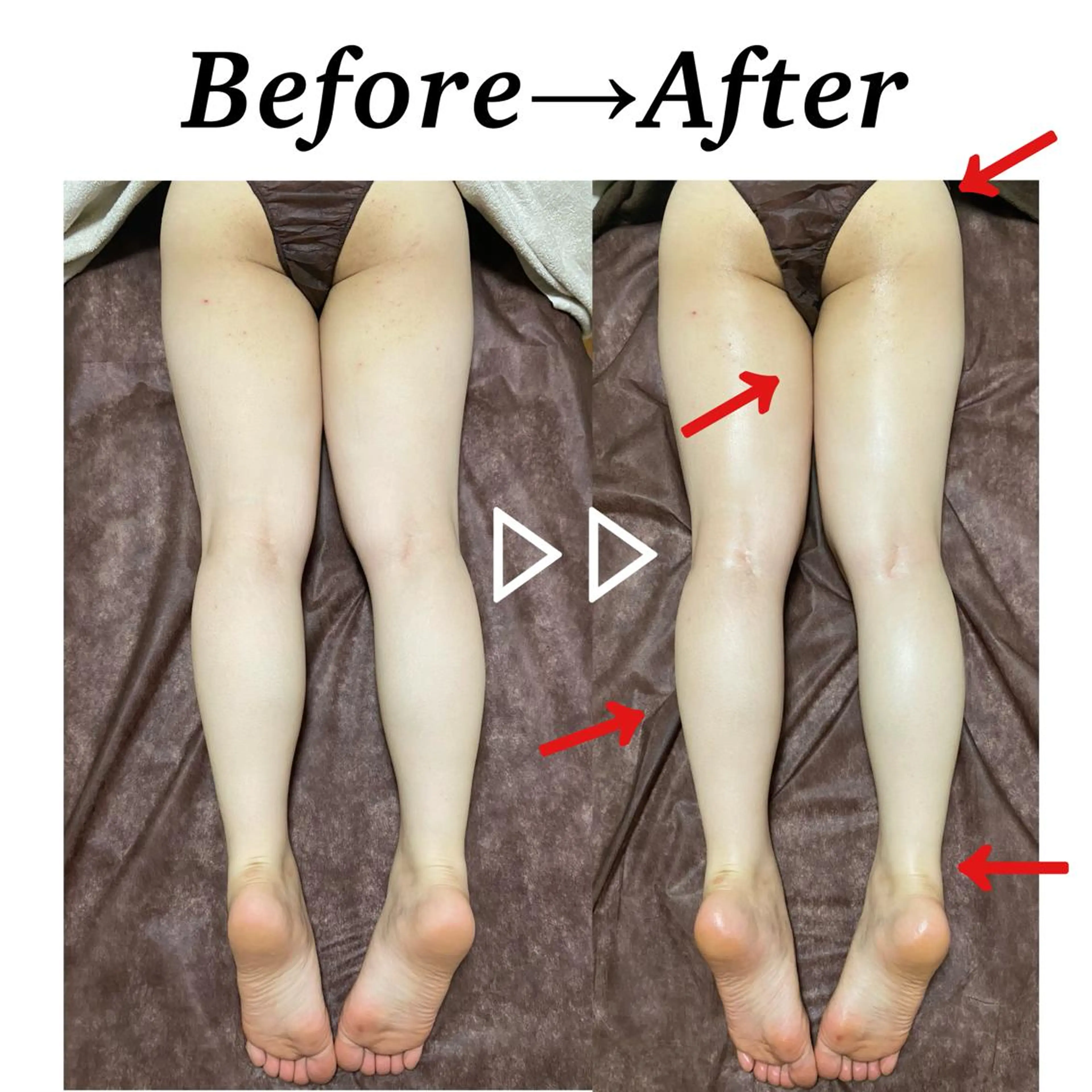 Bellesthe （ベルエステ）のエステ・リラクイメージ