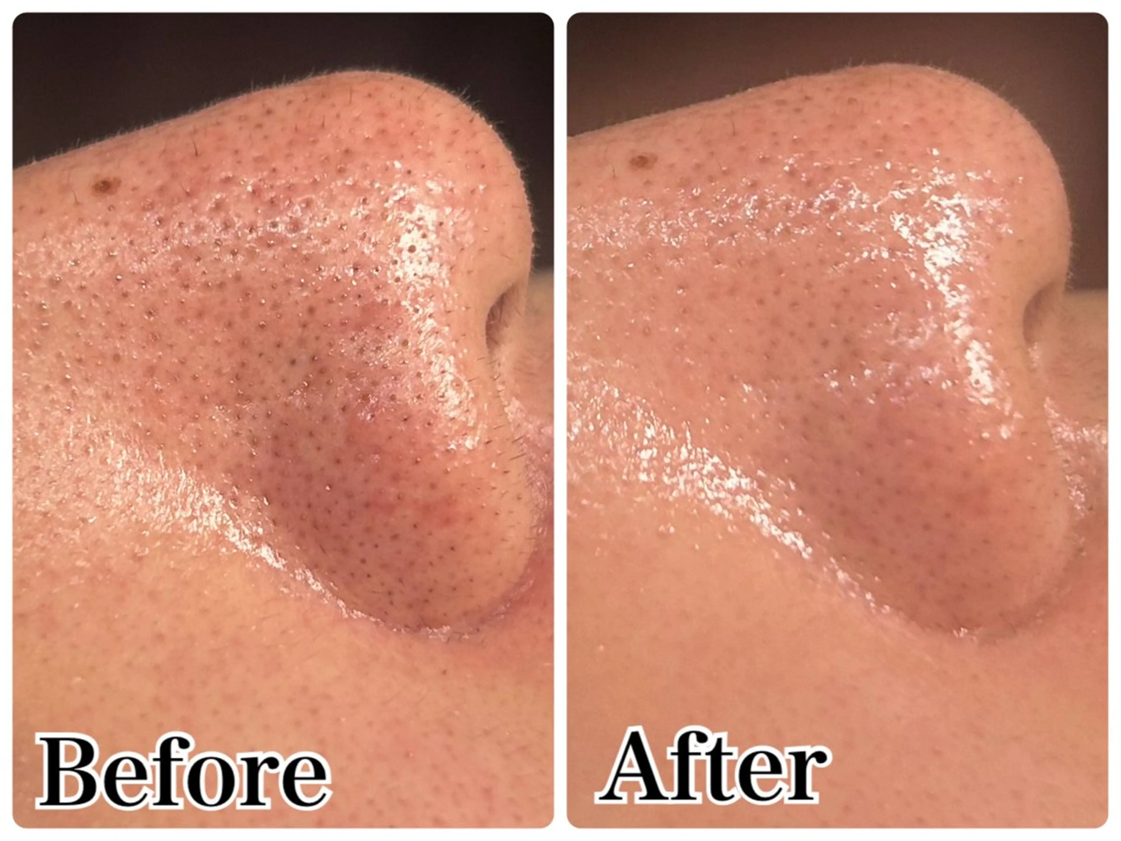 エステ Gemini 　MIKIのエステ・リラクイメージ