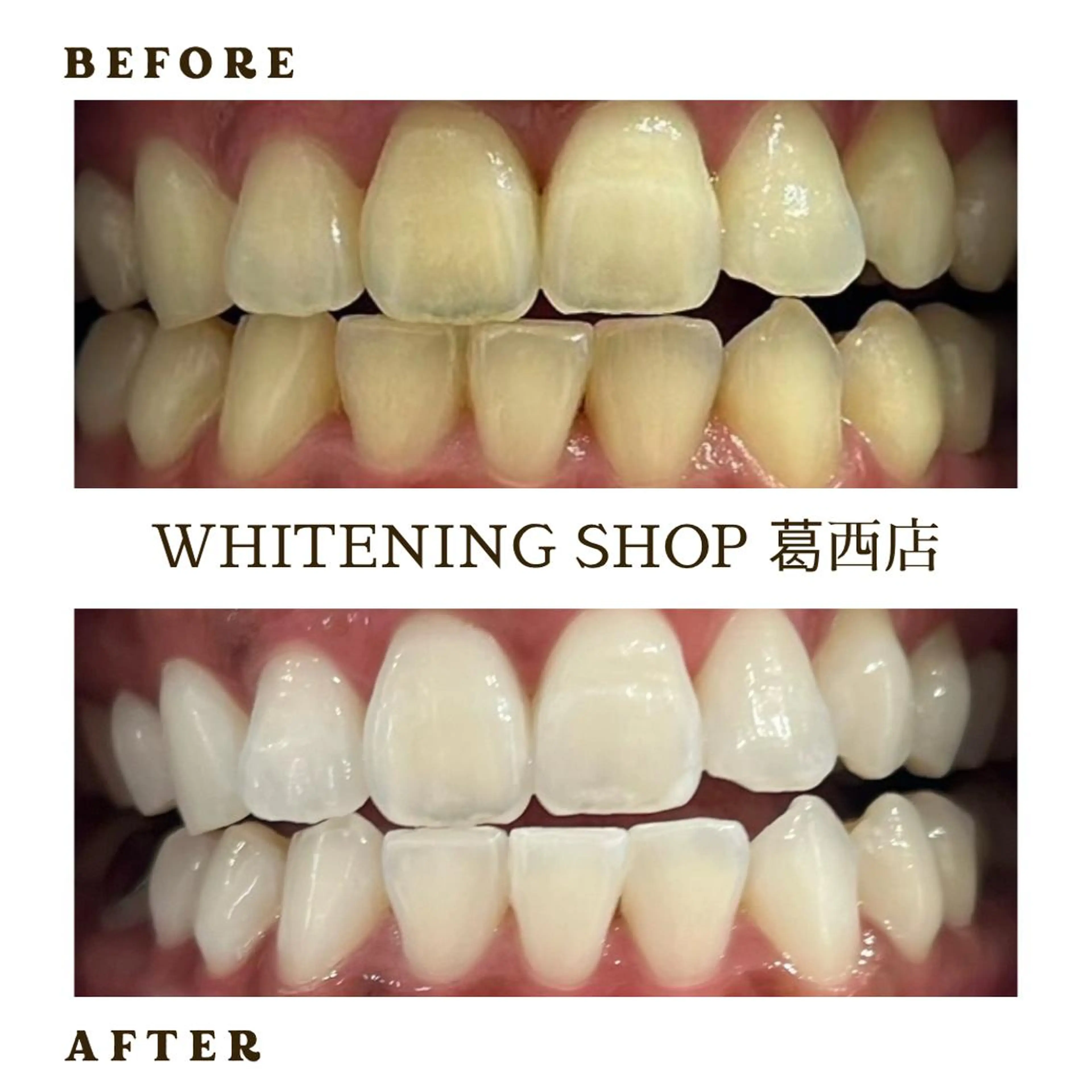 メンズ その他 ホワイトニング ショップ葛西店のその他イメージ