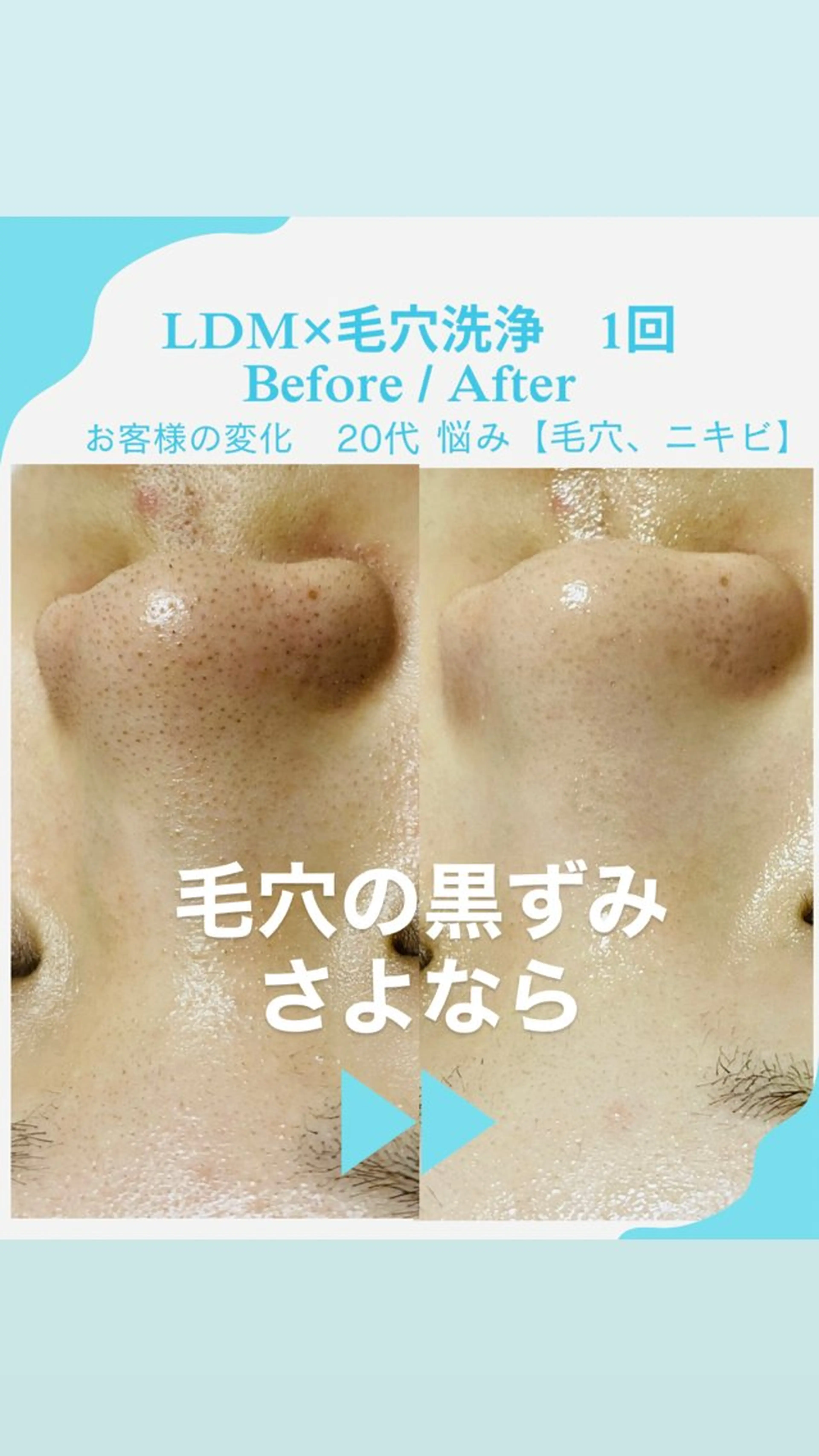 エステ 小西 綾香のエステ・リラクイメージ