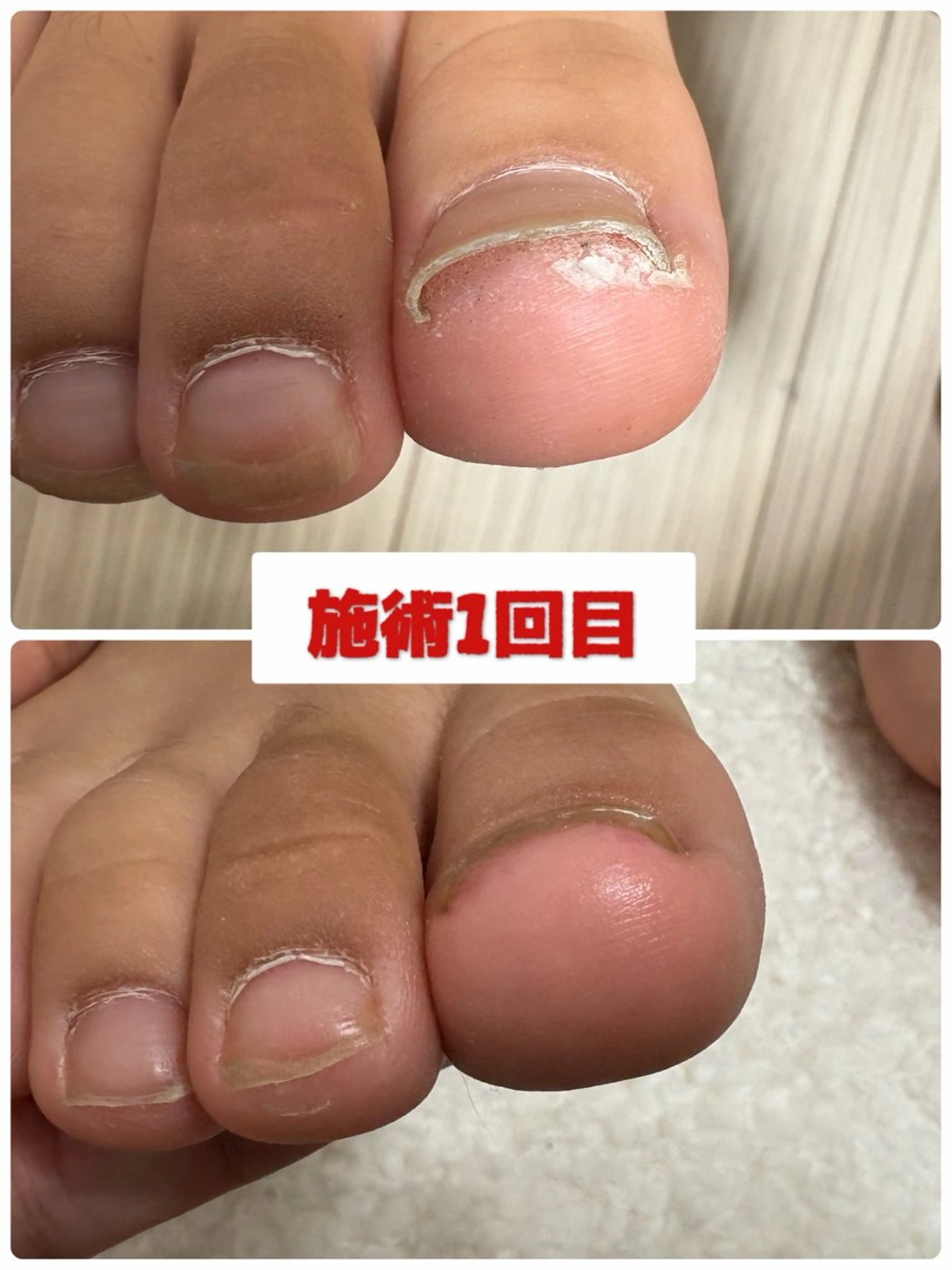 ネイル フットネイル -TOIRO- Eriのネイルデザイン