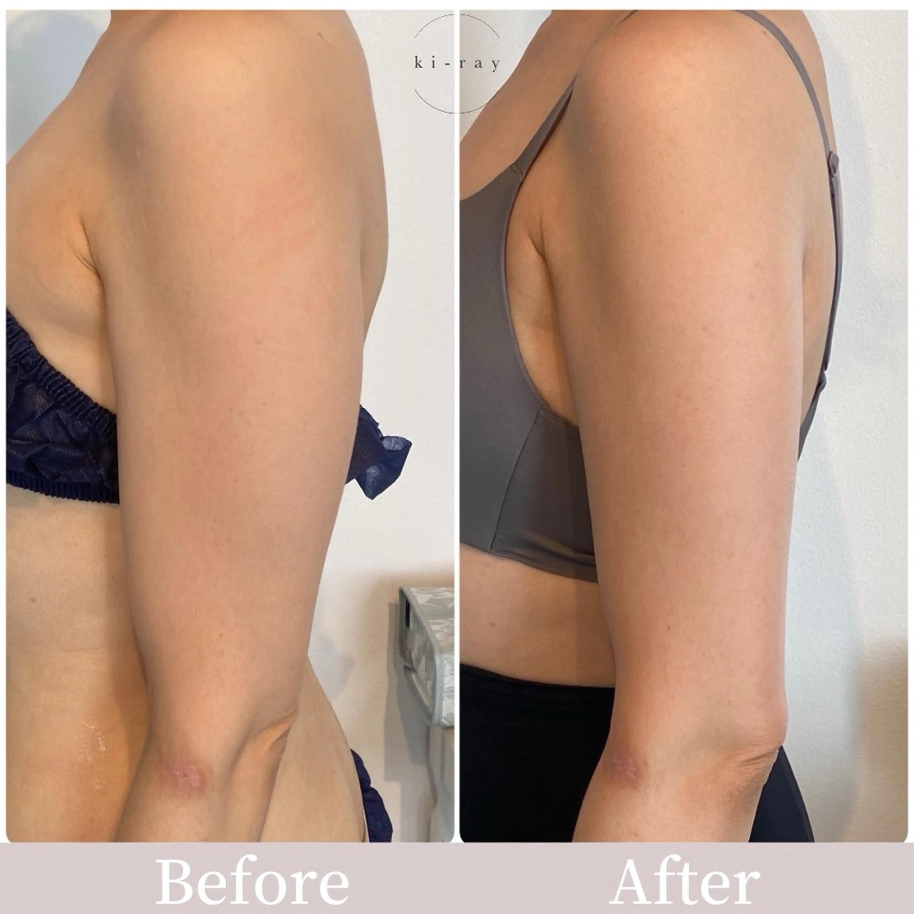 綺麗のひみつ グランプリ受賞店のエステ・リラクイメージ