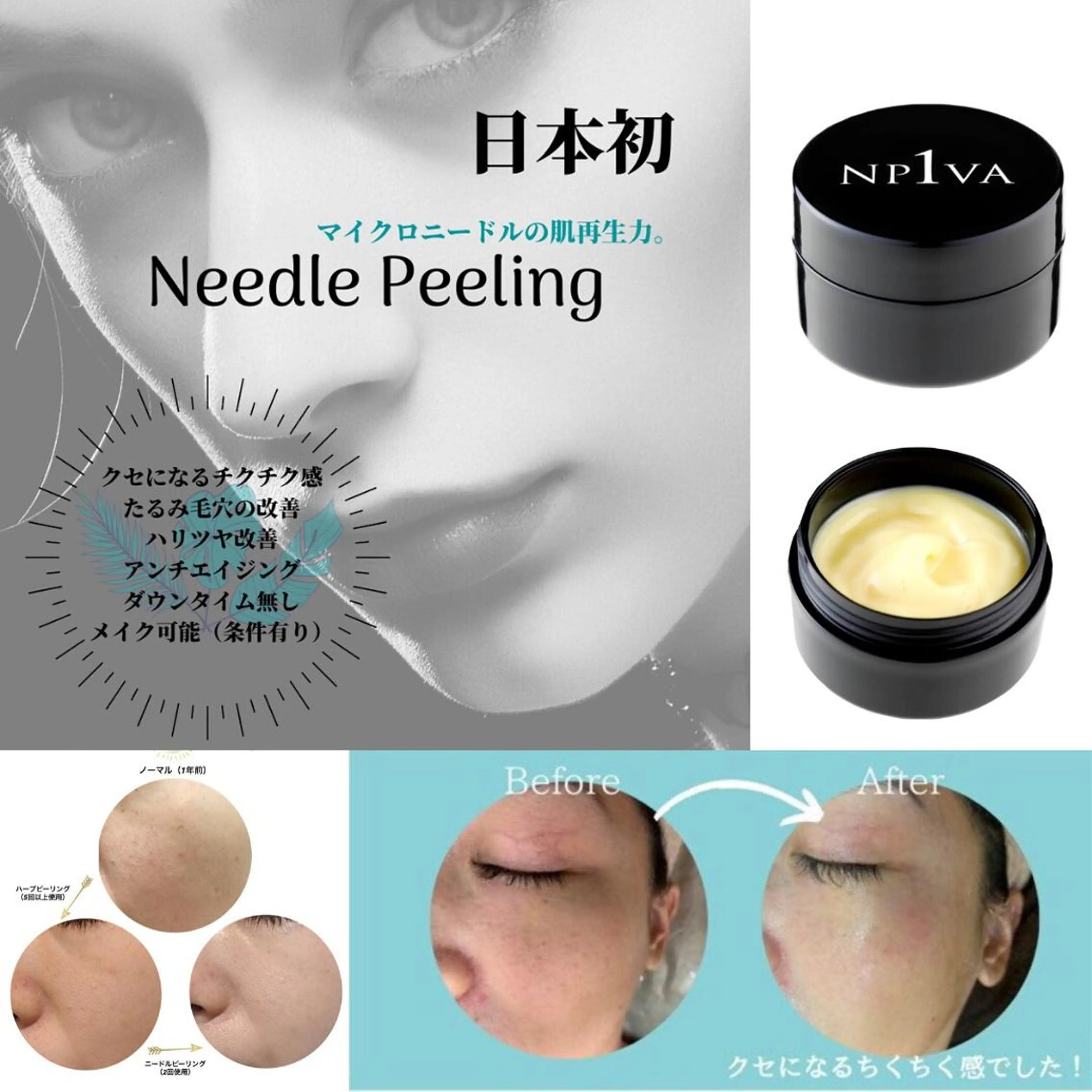 県内希少のフェイシャル新メニュー、ニードルピーリングVA【艶肌革命◎圧倒的ハリと弾む肌】クレンジング無しの写真