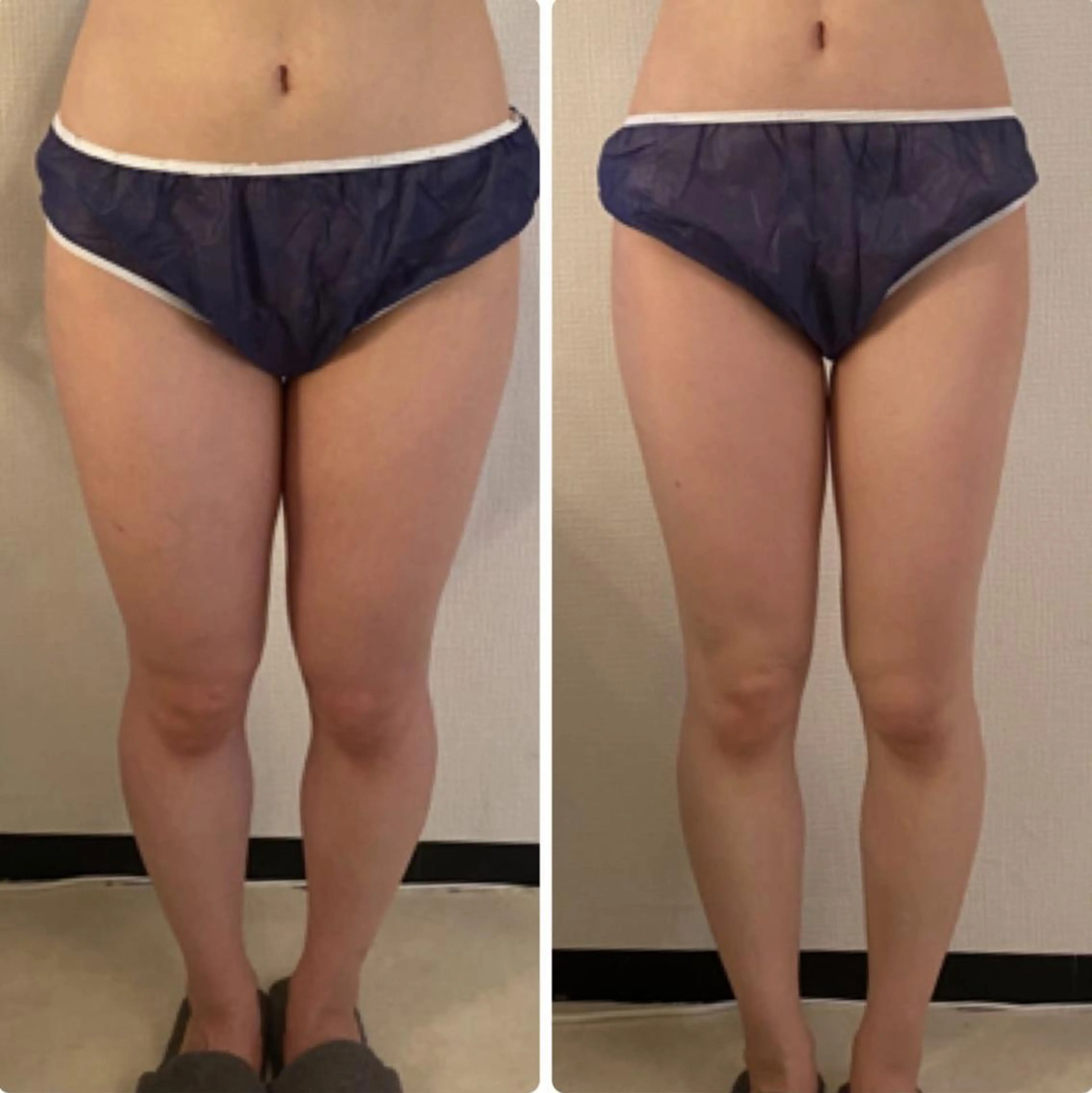 エステ リラク 池田 紀香のエステ・リラクイメージ