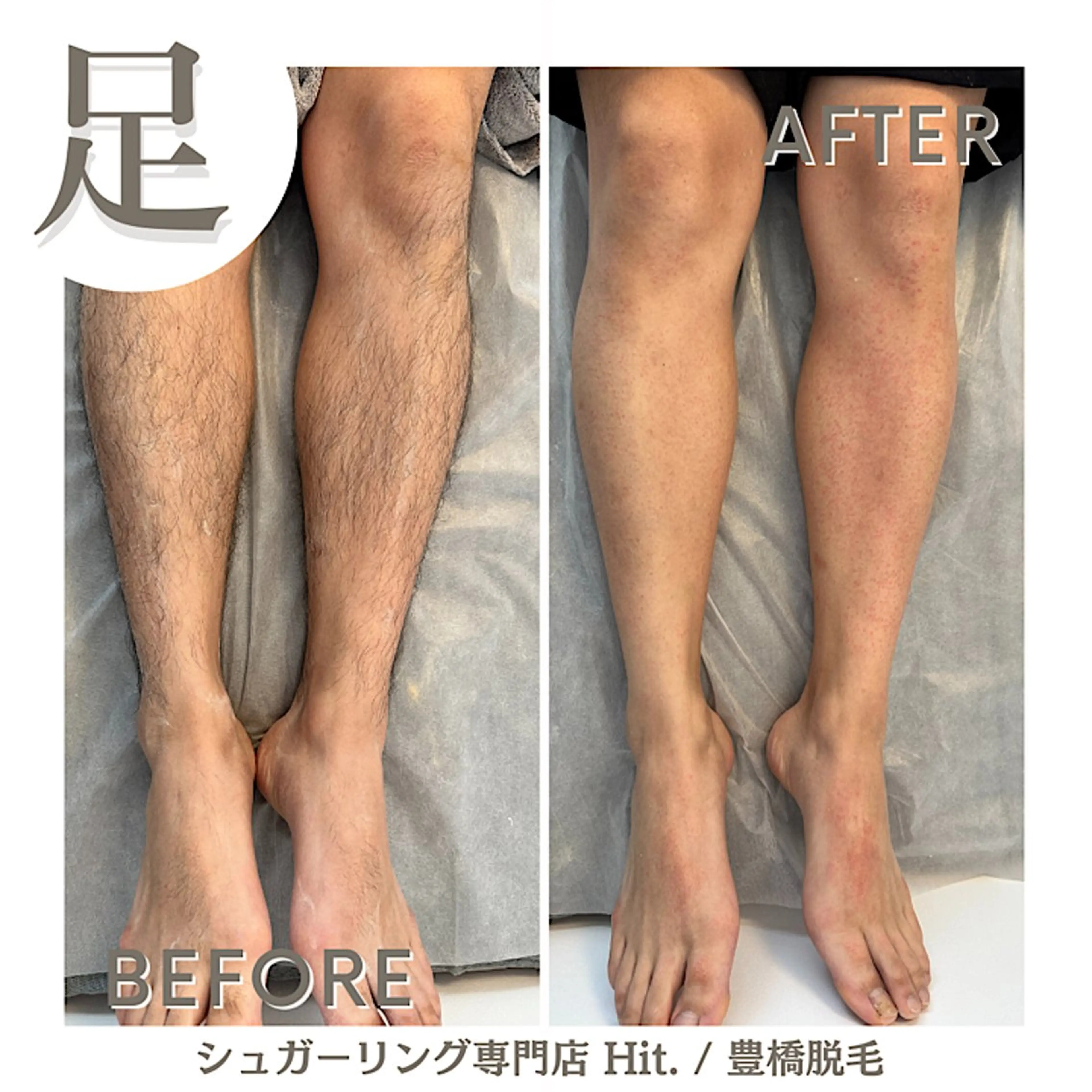 Hitomi シュガーリング豊橋のその他イメージ