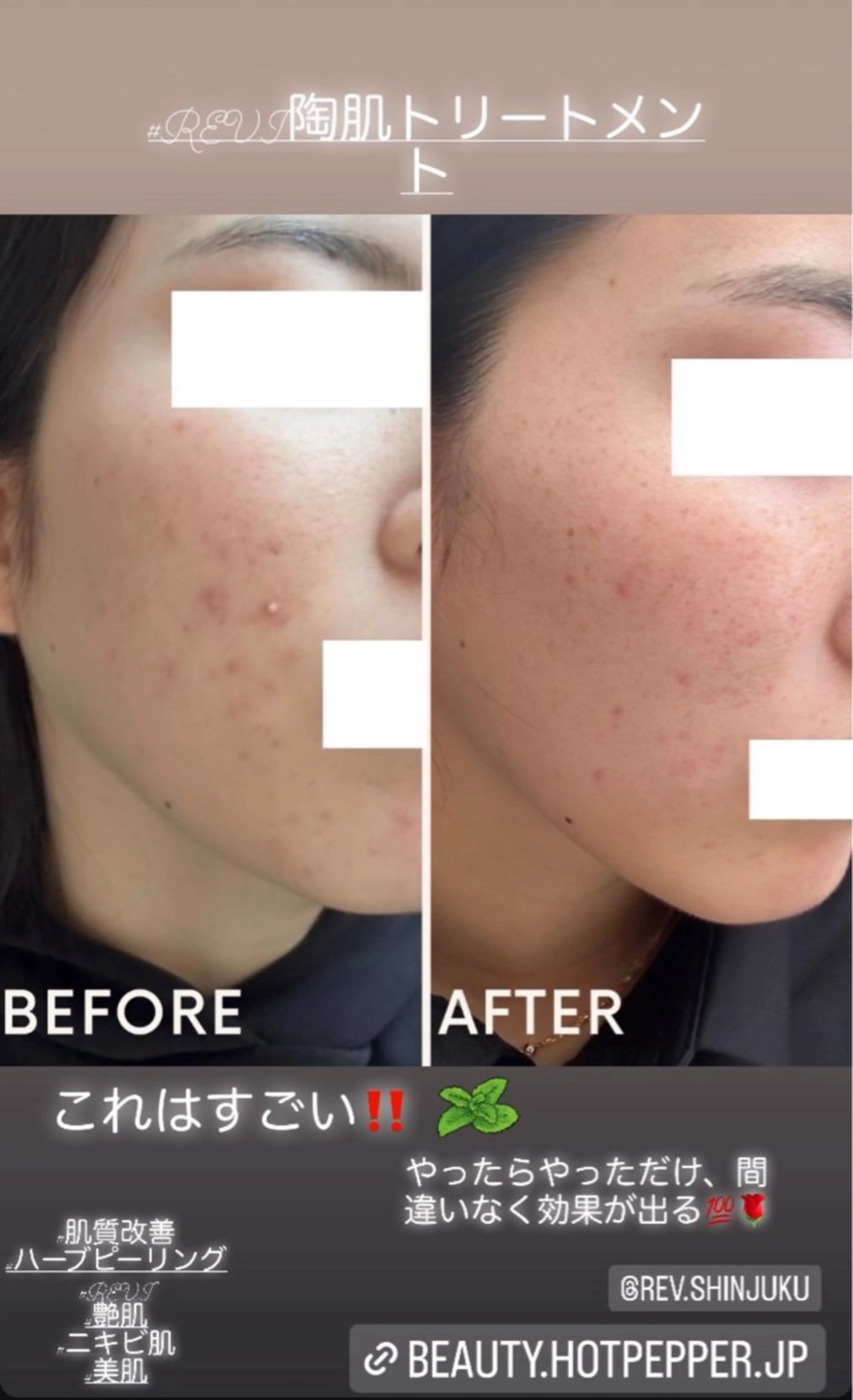 ハーブピーリング専門 毛穴洗浄❤️眉waxのエステ・リラクイメージ