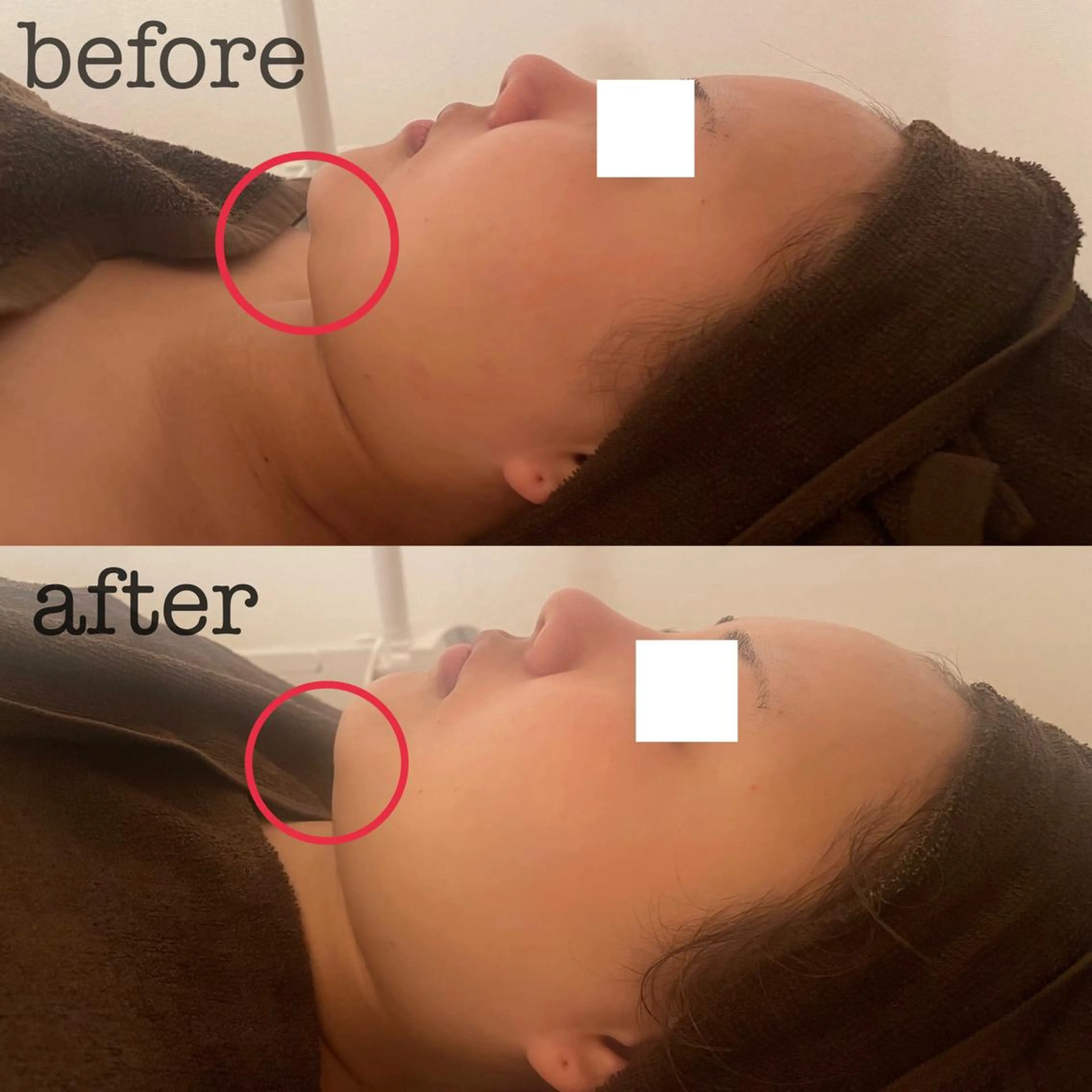 エステ フェイシャル専門店 regalo所属・フェイシャル専門店 regaloのエステ・リラクイメージ